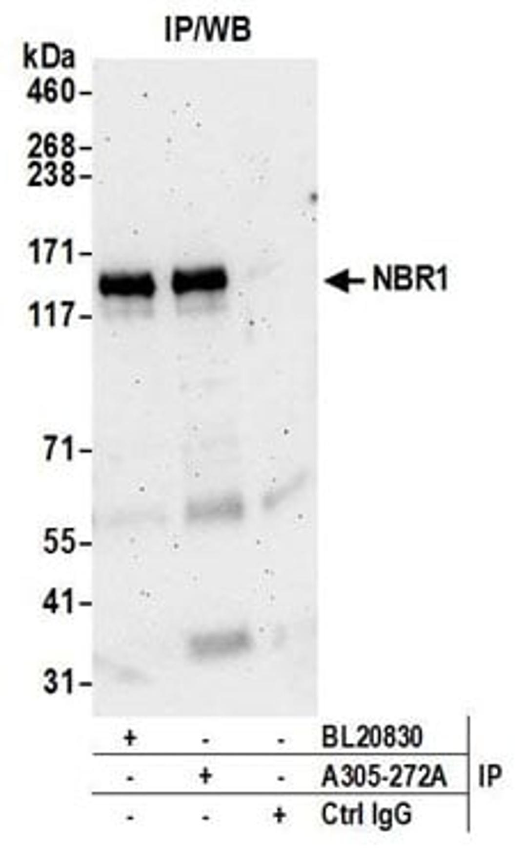 Detection of human NBR1 by western blot of immunoprecipitates.