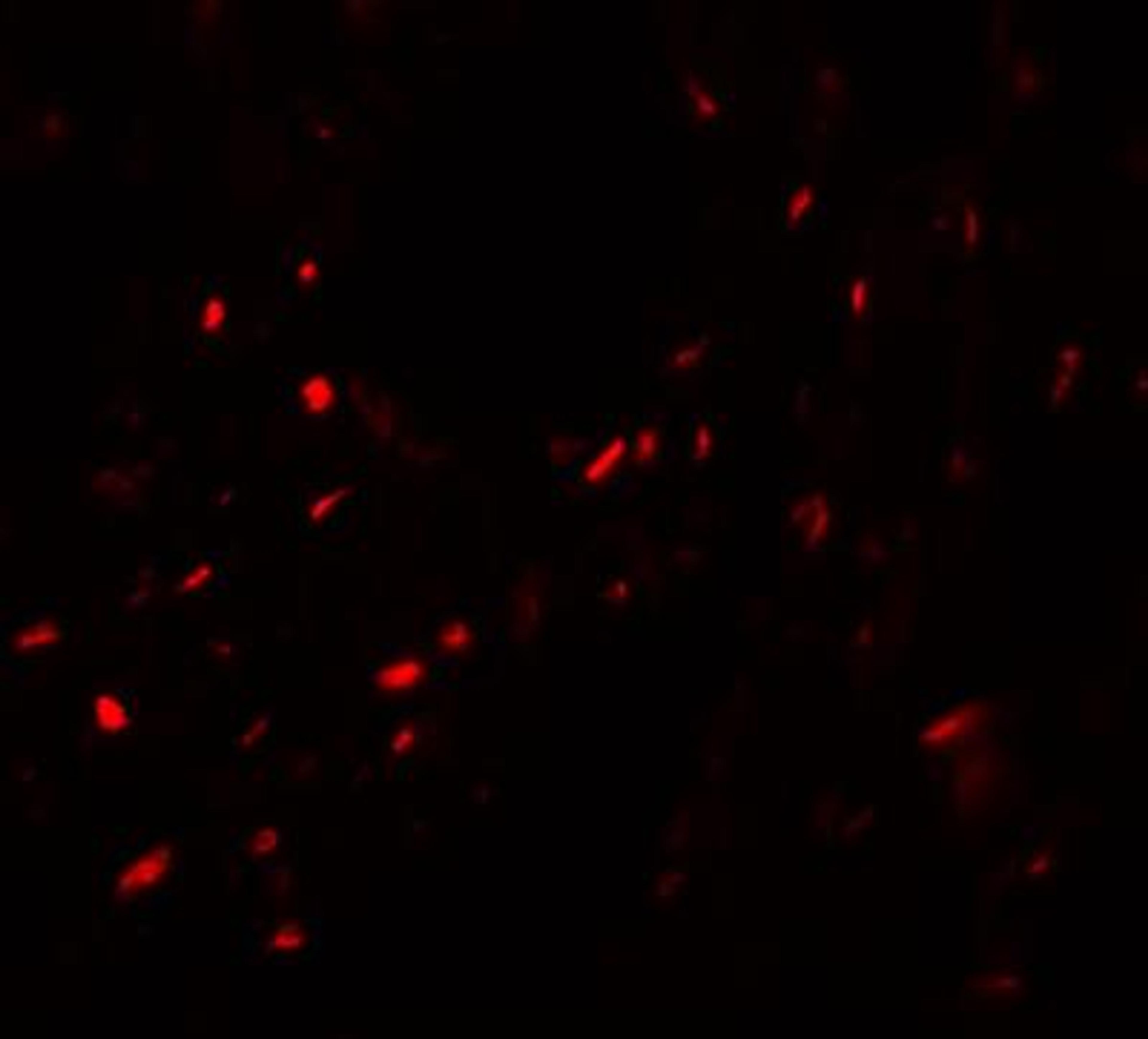 Immunocytochemistry/Immunofluorescence: MYOZAP Antibody [NBP1-76547] - Immunofluorescence of MYOZAP in human lung tissue with MYOZAP antibody at 20 ug/mL.