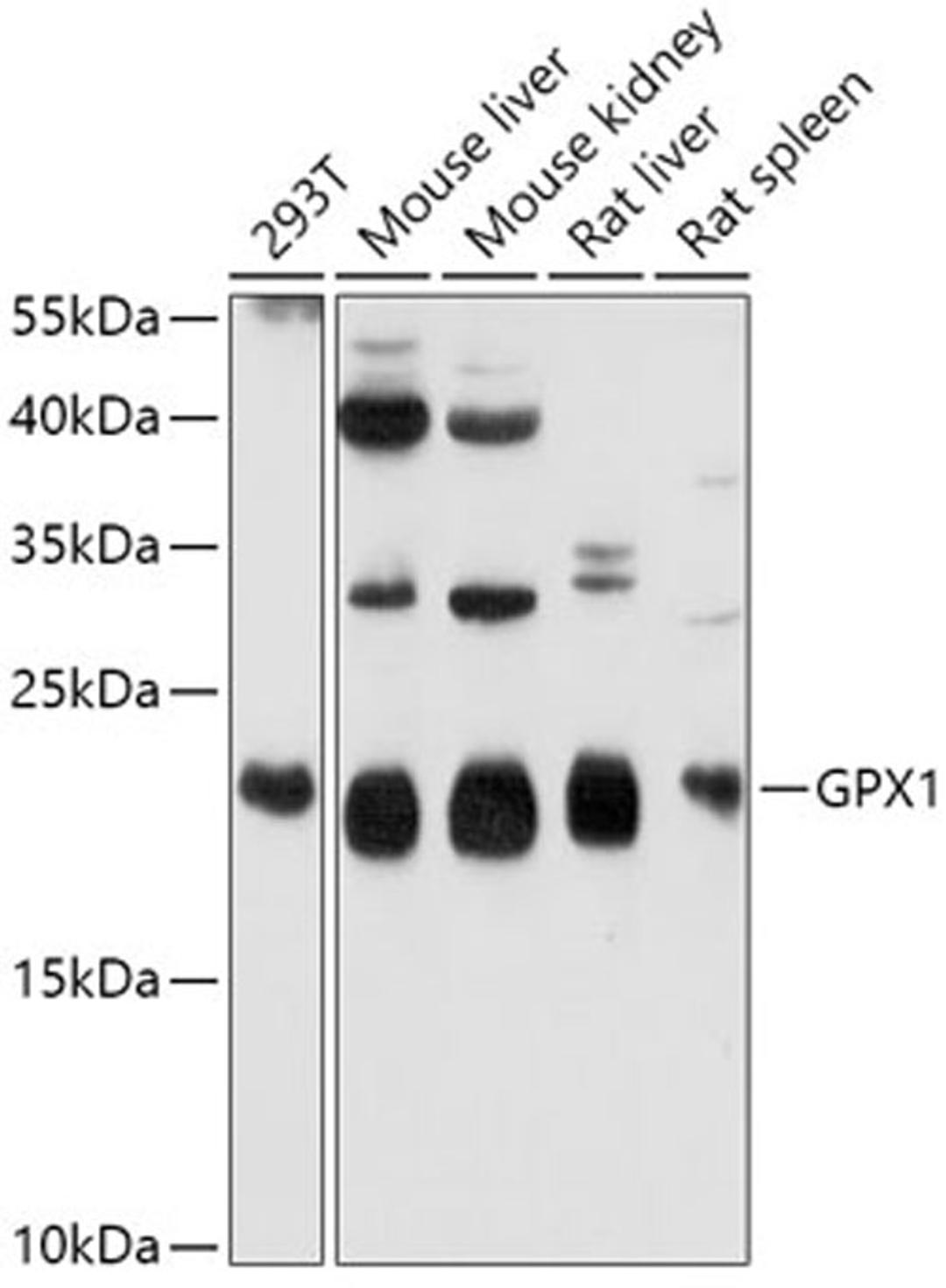 Western blot - GPX1 antibody (A1110)