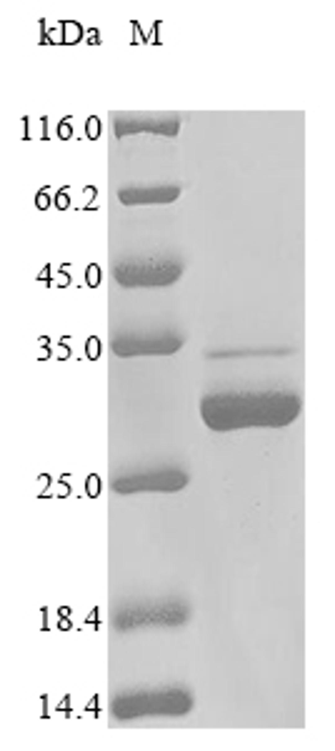 (Tris-Glycine gel) Discontinuous SDS-PAGE (reduced) with 5% enrichment gel and 15% separation gel.
