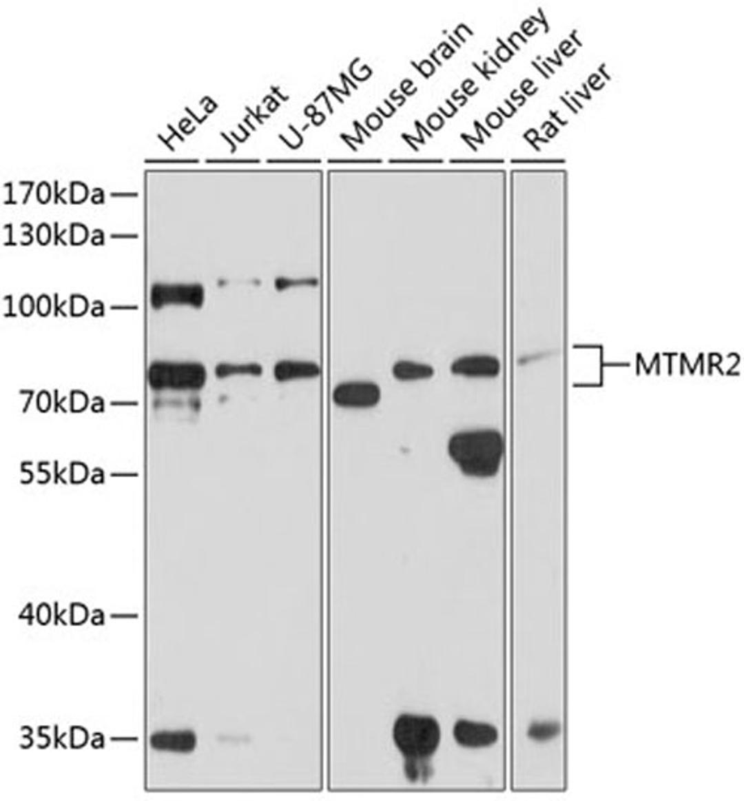 Western blot - MTMR2 antibody (A8993)