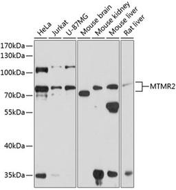 Western blot - MTMR2 antibody (A8993)