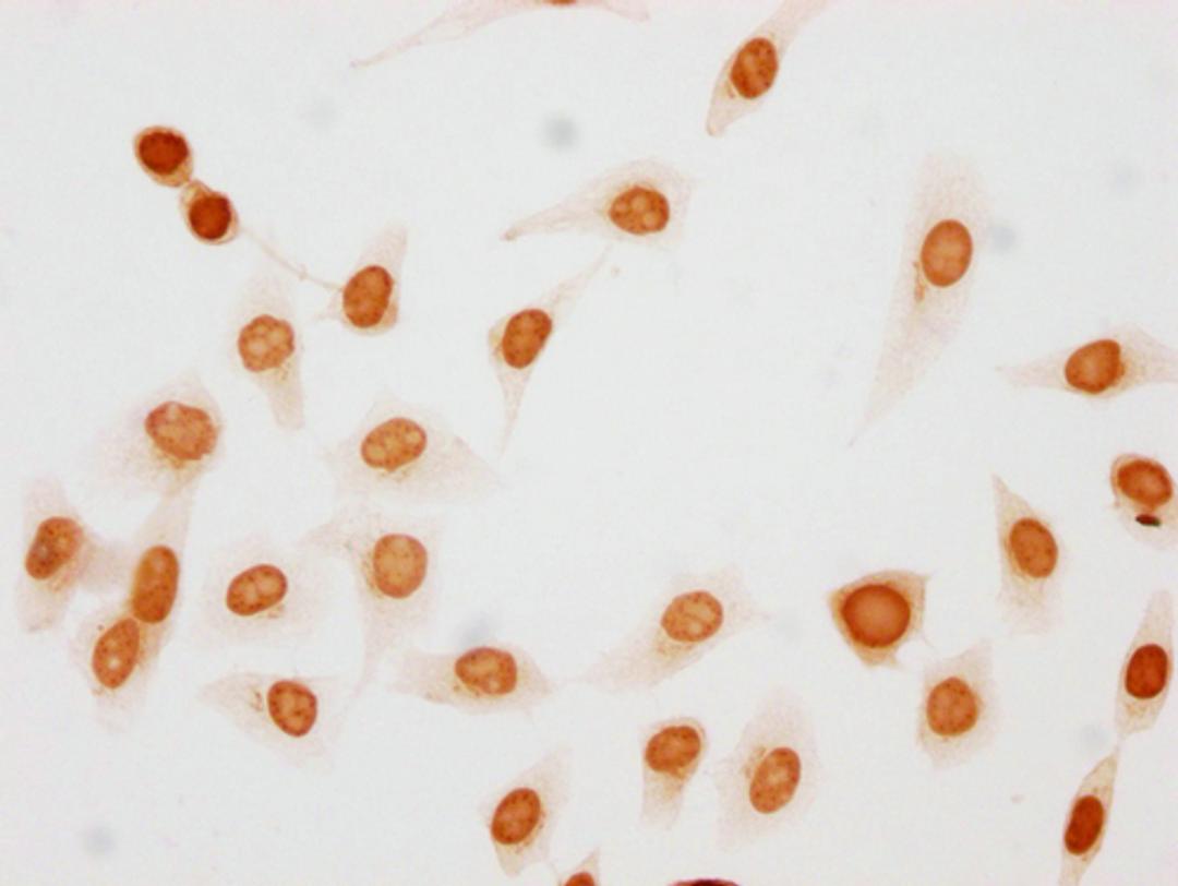 Immunocytochemistry analysis of CSB-PA010377OA10phHU diluted at 1:50 and staining in Hela cells(treated with 50nM Calyculin A for 30min) performed on a Leica BondTM system. The cells were fixed in 4% formaldehyde, permeabilized using 0.2% Triton X-100 and blocked with 10% normal goat serum 30min at RT. Then primary antibody (1% BSA) was incubated at 4°C overnight. The primary is detected by a biotinylated secondary antibody and visualized using an HRP conjugated SP system.