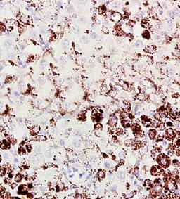 Immunohistrochemical analysis of formalin fixed and paraffin embedded mouse melanoma tissue using Melan-A/Mart-1 antibody