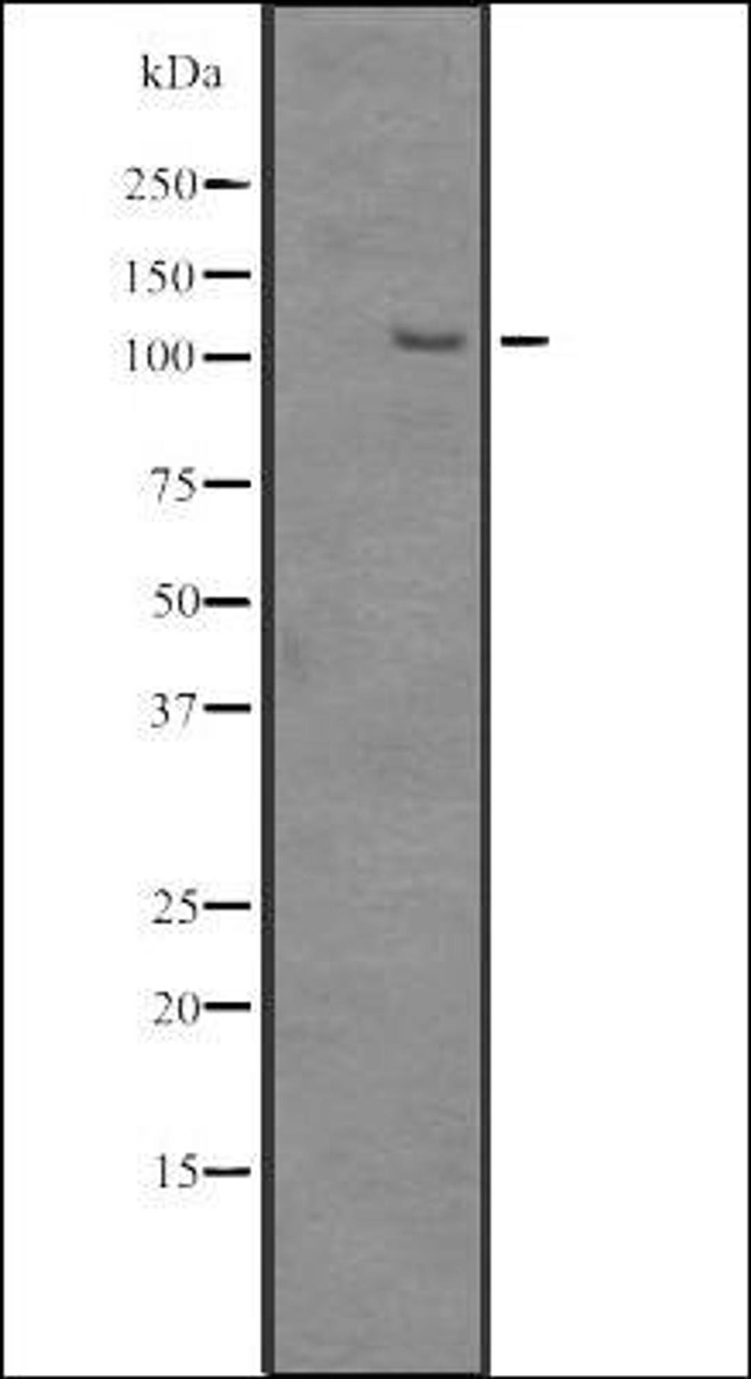 Western blot analysis of HEK293 cells using SRRM1 antibody