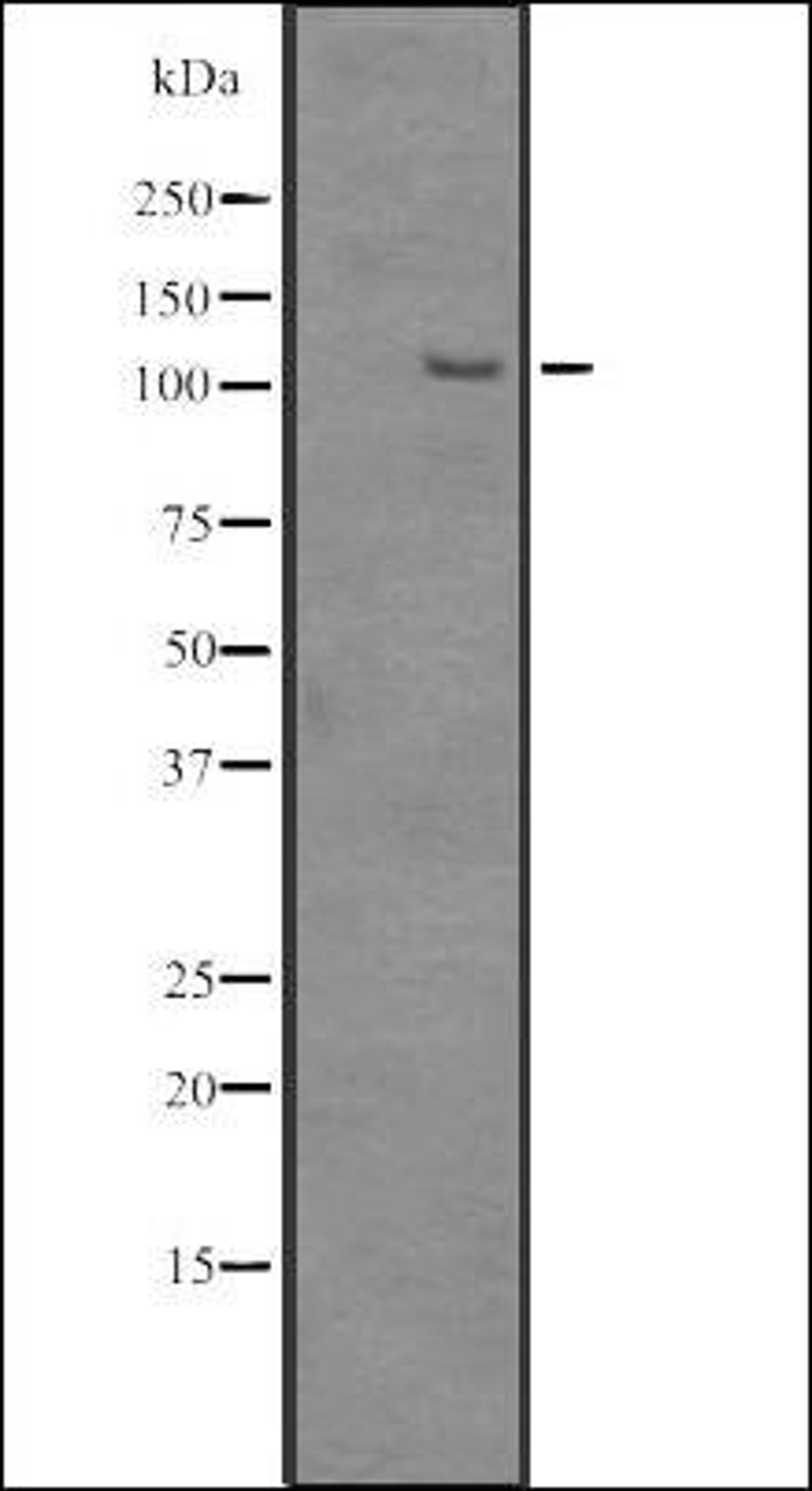 Western blot analysis of HEK293 cells using SRRM1 antibody