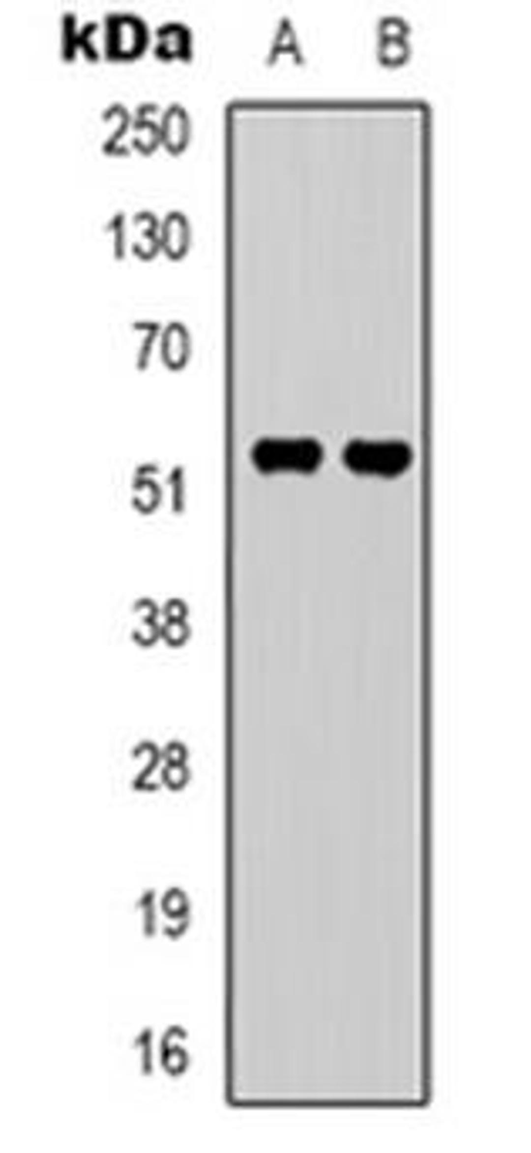 Western blot analysis of GPR37L1 expression in A549 (Lane 1), Hela (Lane 2) whole cell lysates using GPR37L1 antibody