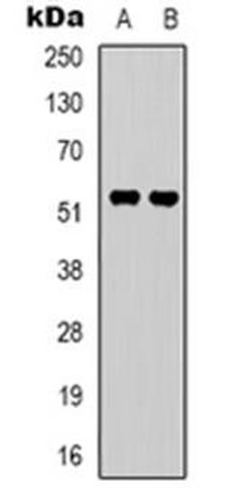 Western blot analysis of GPR37L1 expression in A549 (Lane 1), Hela (Lane 2) whole cell lysates using GPR37L1 antibody