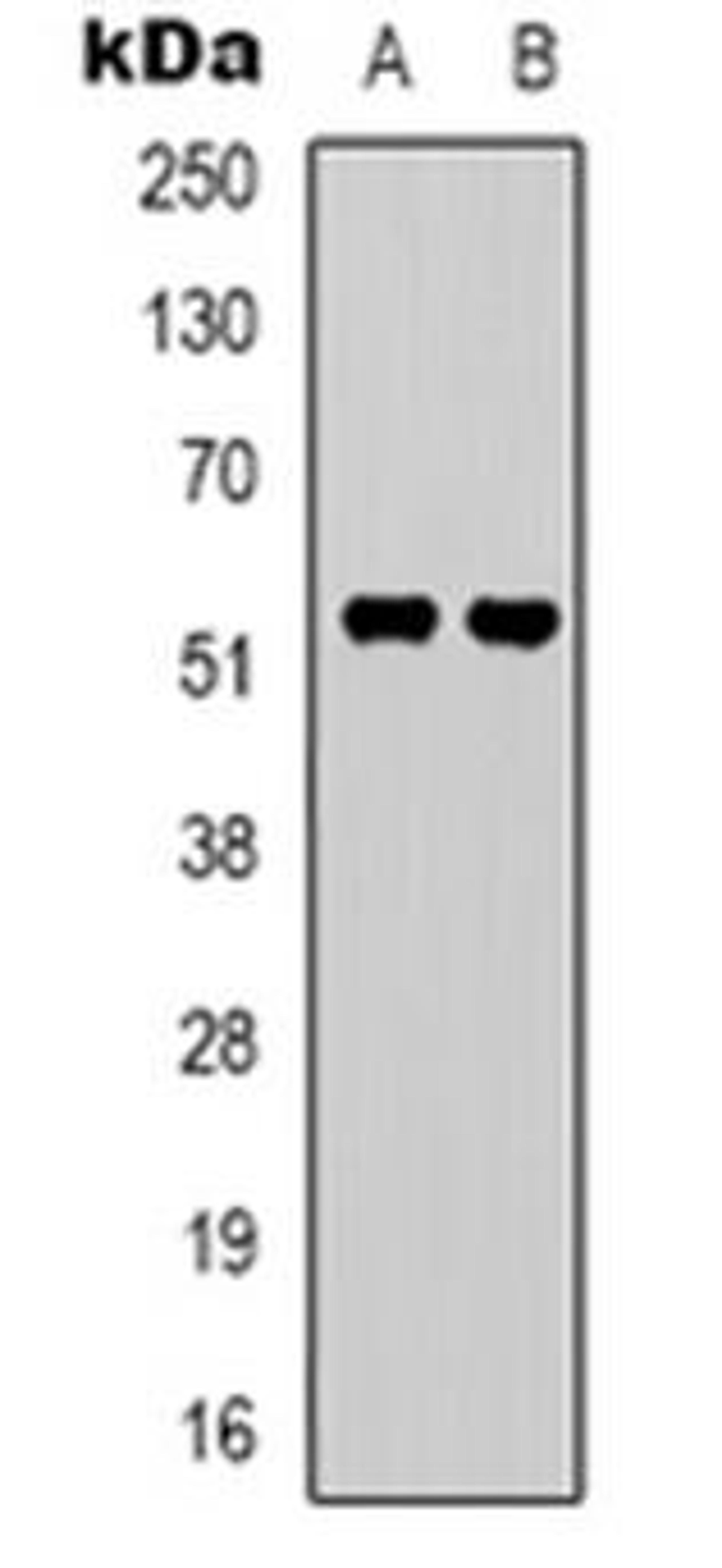 Western blot analysis of GPR37L1 expression in A549 (Lane 1), Hela (Lane 2) whole cell lysates using GPR37L1 antibody