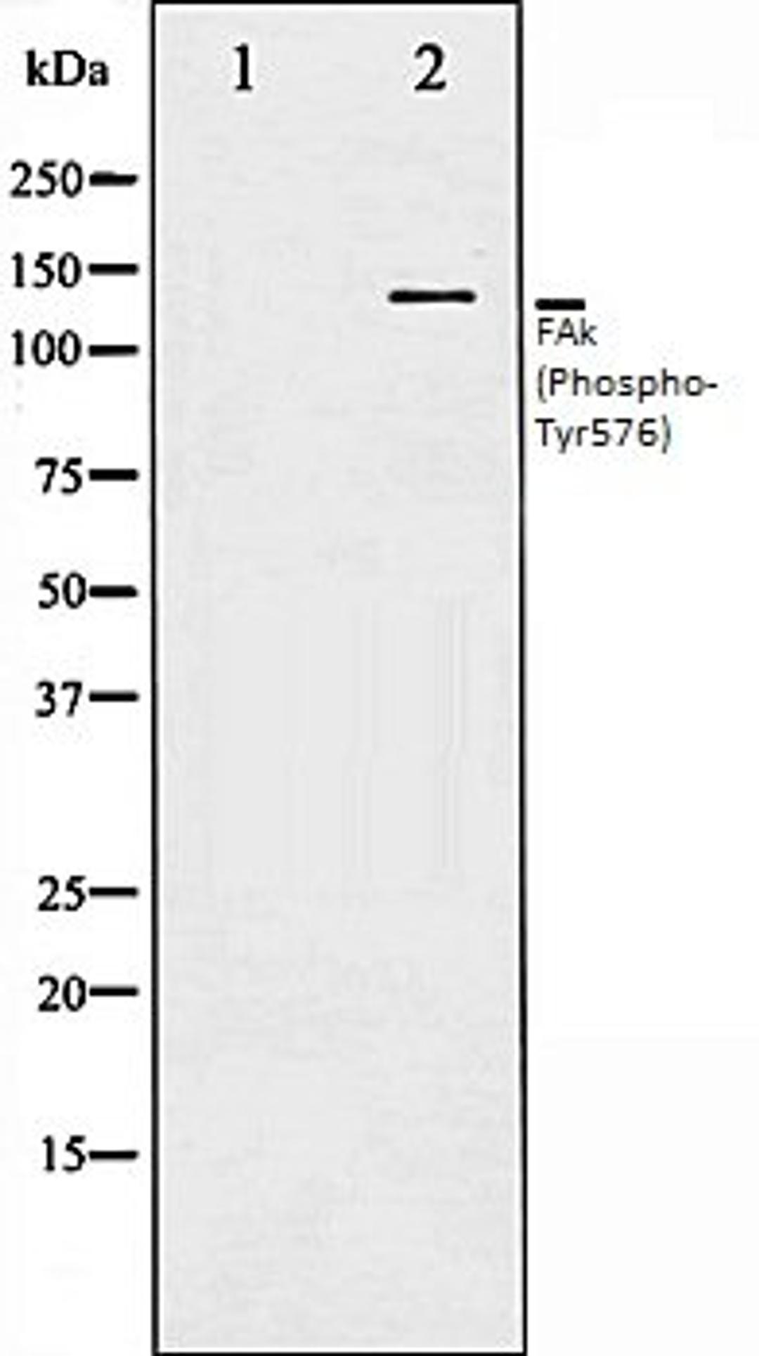 Western blot analysis of NIH-3T3 whole cell lysates using FAK (Phospho-Tyr576) antibody, The lane on the left is treated with the antigen-specific peptide.