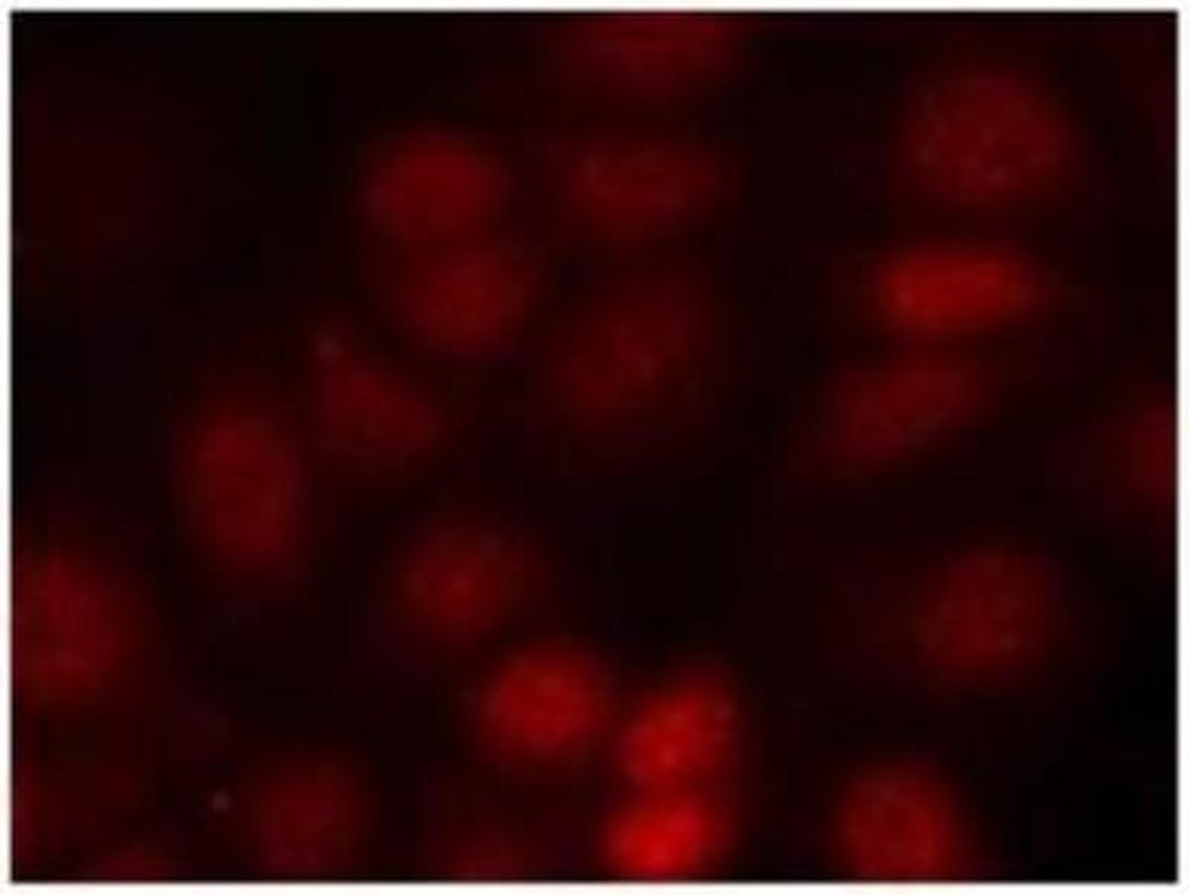 Immunocytochemistry/Immunofluorescence: S6K [p Thr421] Antibody [NB100-82118] - Staining of methanol-fixed MCF cells using p70 S6 kinase (Phospho-Thr421) antibody.