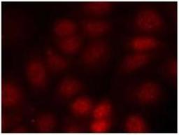 Immunocytochemistry/Immunofluorescence: S6K [p Thr421] Antibody [NB100-82118] - Staining of methanol-fixed MCF cells using p70 S6 kinase (Phospho-Thr421) antibody.