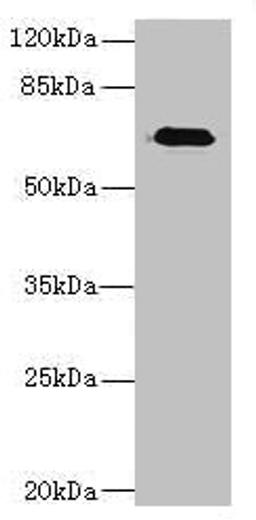 Western blot. All lanes: CAPN6 antibody at 5ug/ml + Human placenta tissue. Secondary. Goat polyclonal to rabbit IgG at 1/10000 dilution. Predicted band size: 75 kDa. Observed band size: 75 kDa. 