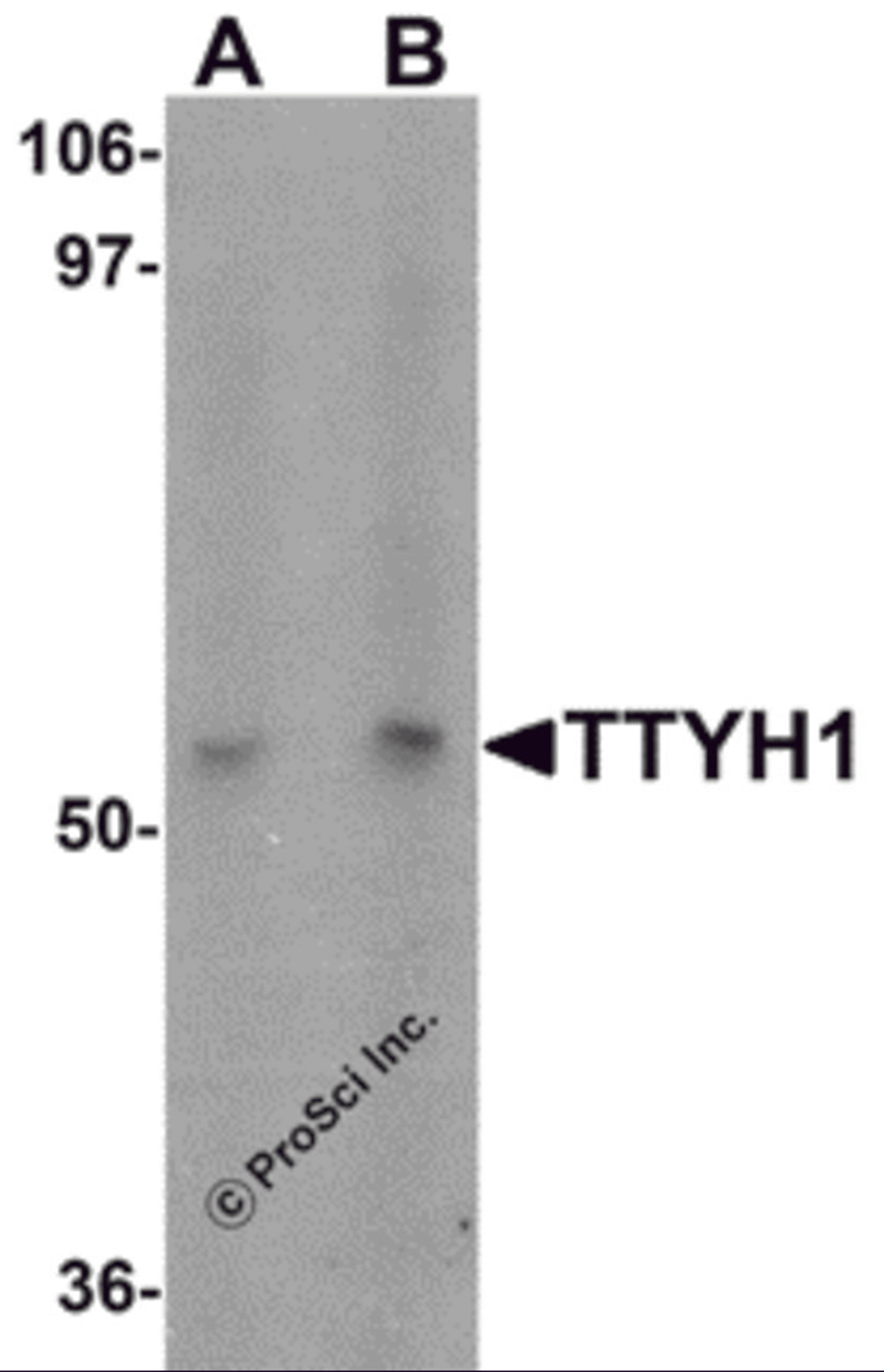 Western blot analysis of TTYH1 in Raji cell lysate with TTYH1 antibody at (A) 1 and (B) 2 &#956;g/mL.