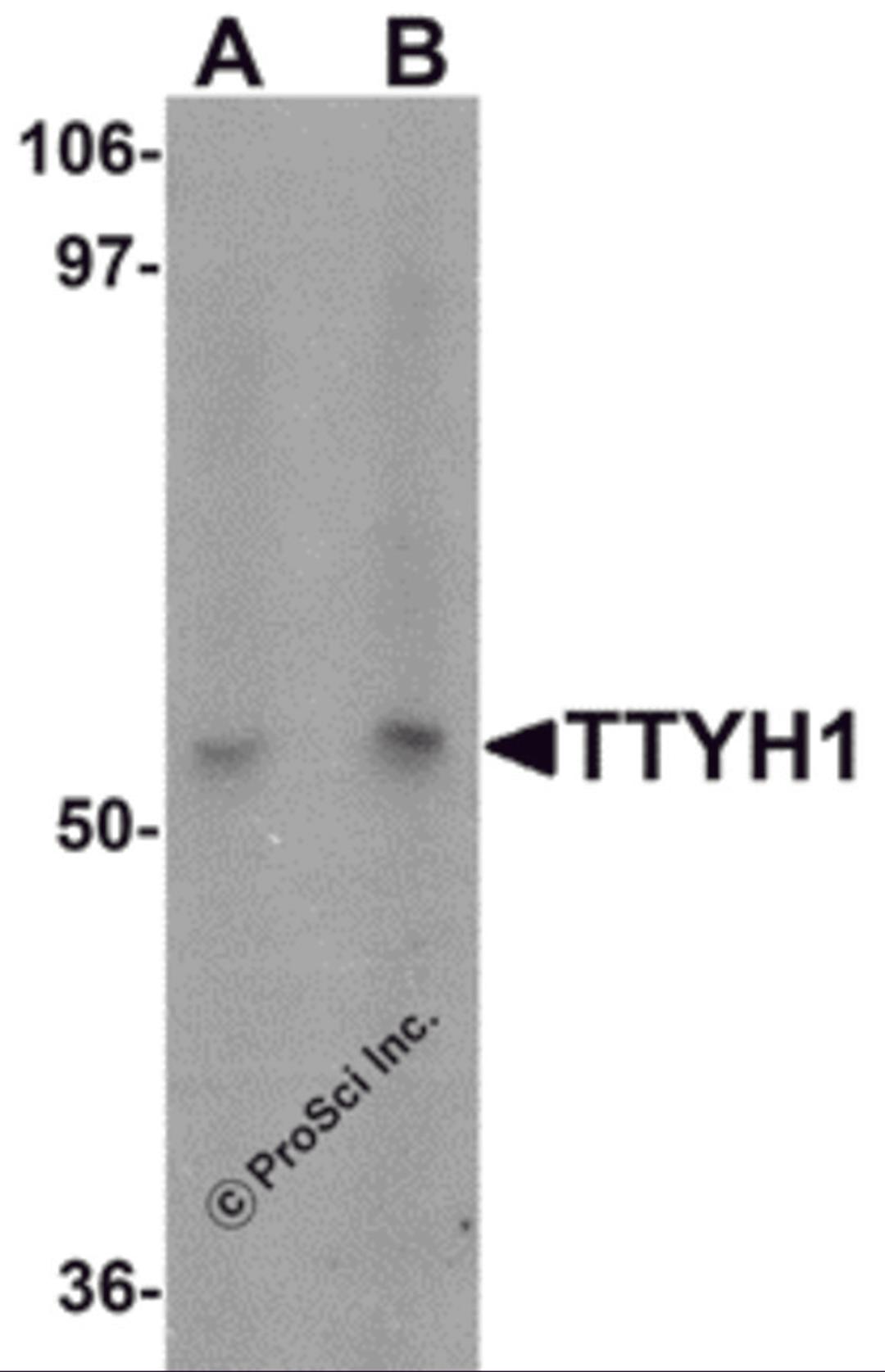 Western blot analysis of TTYH1 in Raji cell lysate with TTYH1 antibody at (A) 1 and (B) 2 μg/mL.