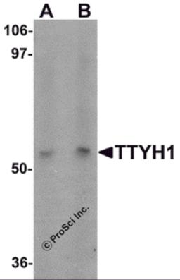 Western blot analysis of TTYH1 in Raji cell lysate with TTYH1 antibody at (A) 1 and (B) 2 μg/mL.