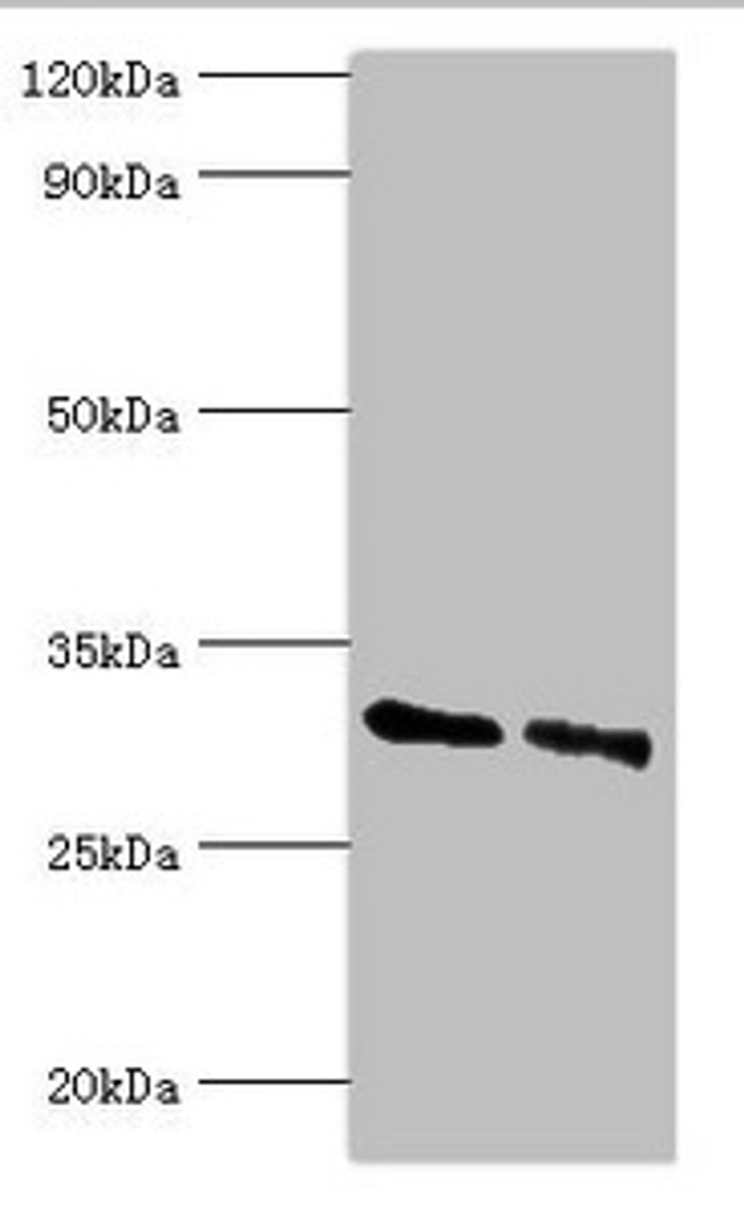 Western blot. All lanes: KCTD15 antibody at 8ug/ml. Lane 1: 293T whole cell lysate. Lane 2: Hela whole cell lysate. Secondary. Goat polyclonal to rabbit IgG at 1/10000 dilution. Predicted band size: 32, 27 kDa. Observed band size: 32 kDa. 