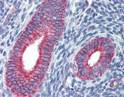 Antibody used in IHC on Human uterus at 5 ug/ml.