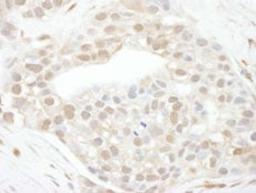 Detection of human Cyclin T1 by immunohistochemistry.