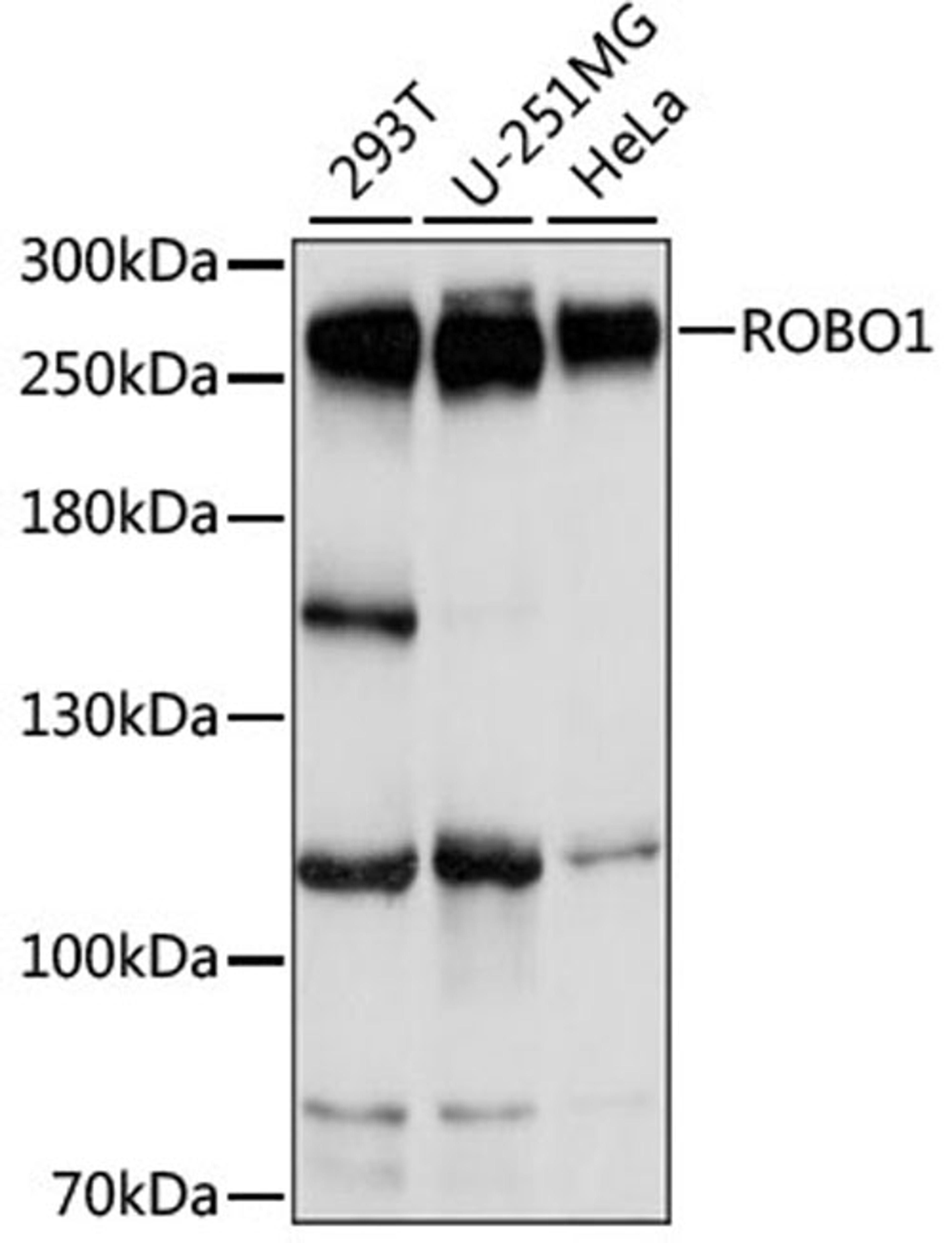 Western blot - ROBO1 antibody (A15313)