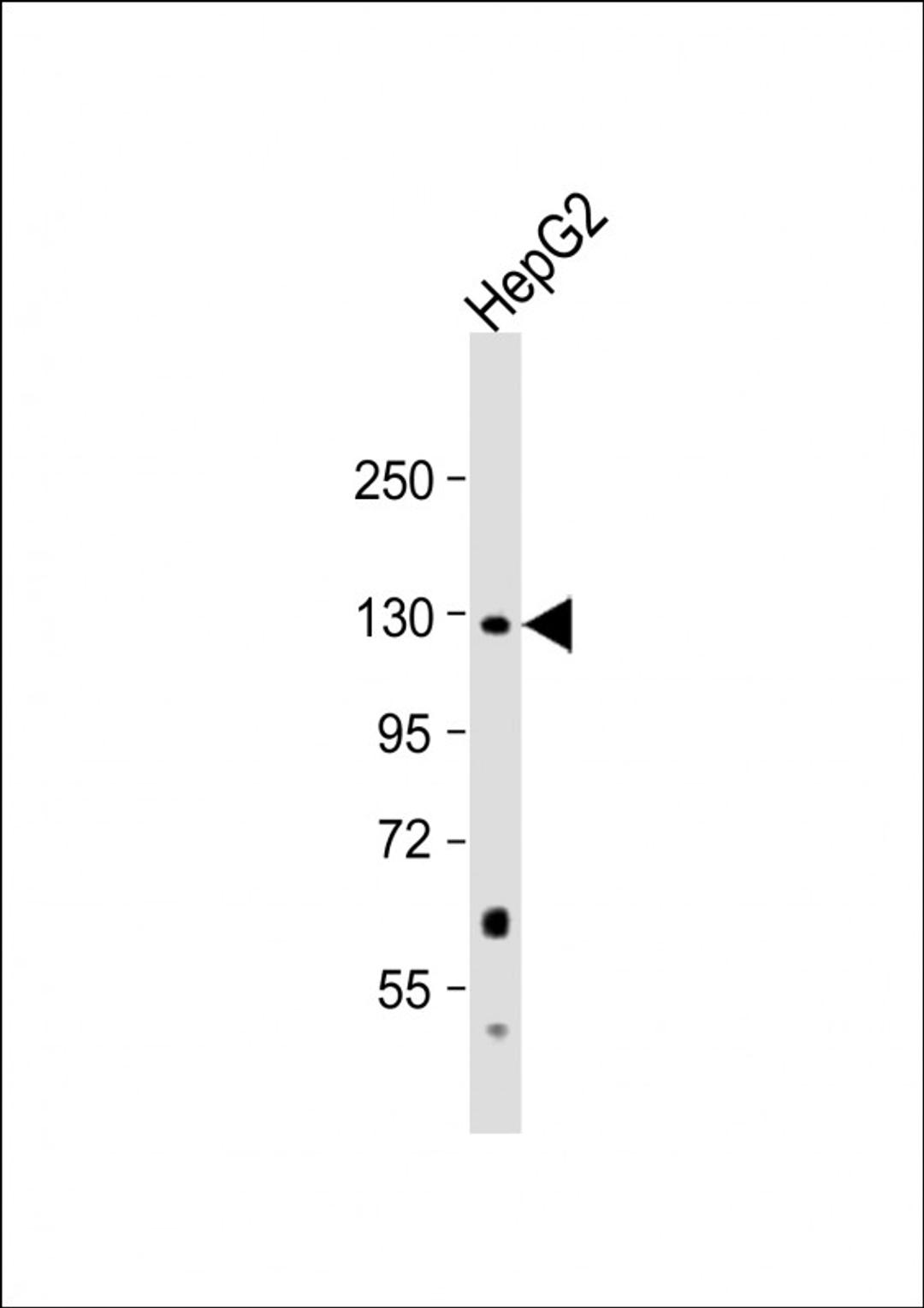 Western Blot at 1:1000 dilution + HepG2 whole cell lysate Lysates/proteins at 20 ug per lane.