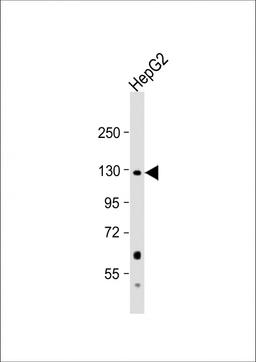 Western Blot at 1:1000 dilution + HepG2 whole cell lysate Lysates/proteins at 20 ug per lane.