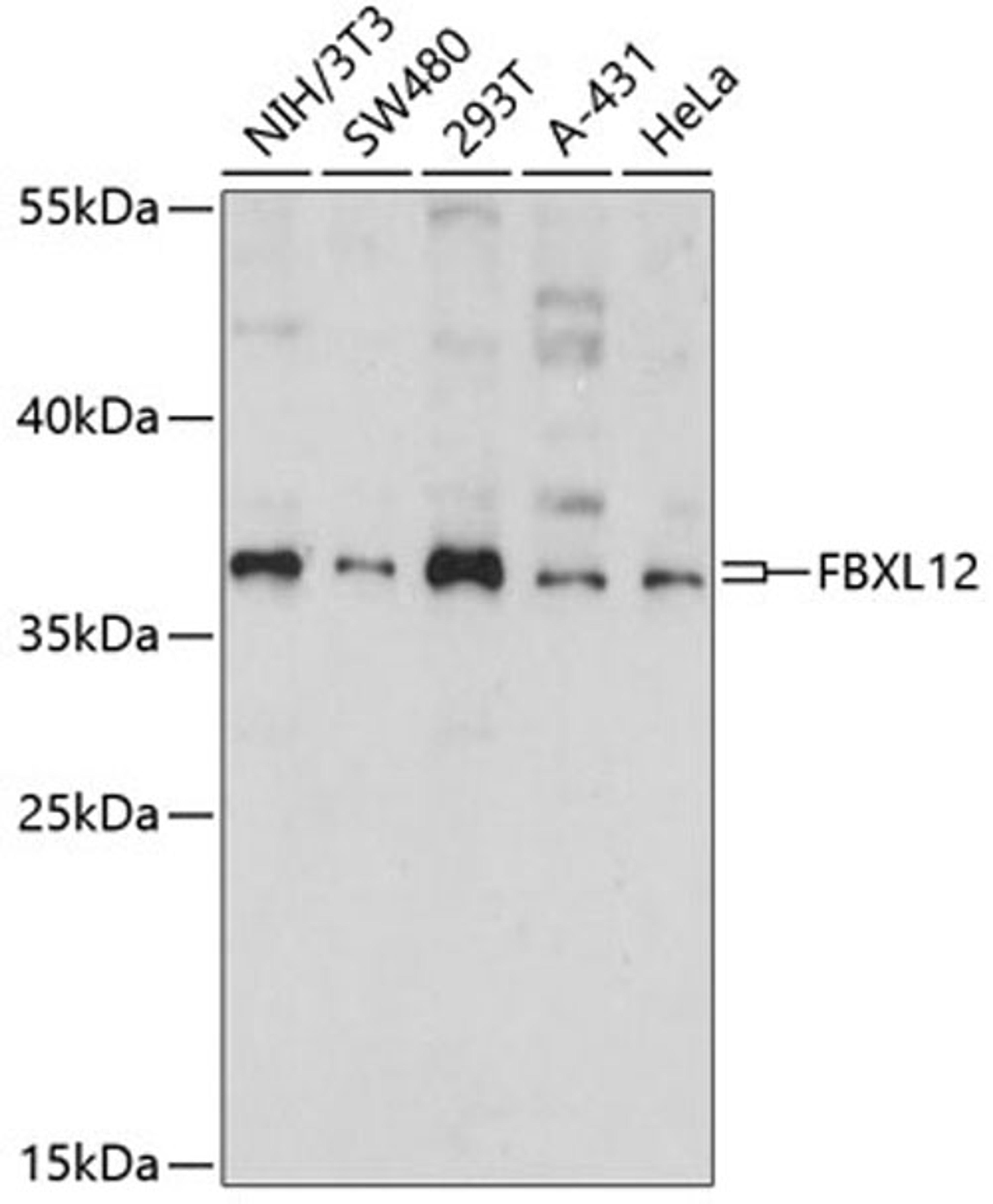 Western blot - FBXL12 antibody (A14589)