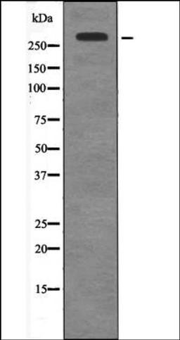 Western blot analysis of EGF treated HepG2 whole cell lysates using Huntingtin -Phospho-Ser421- antibody