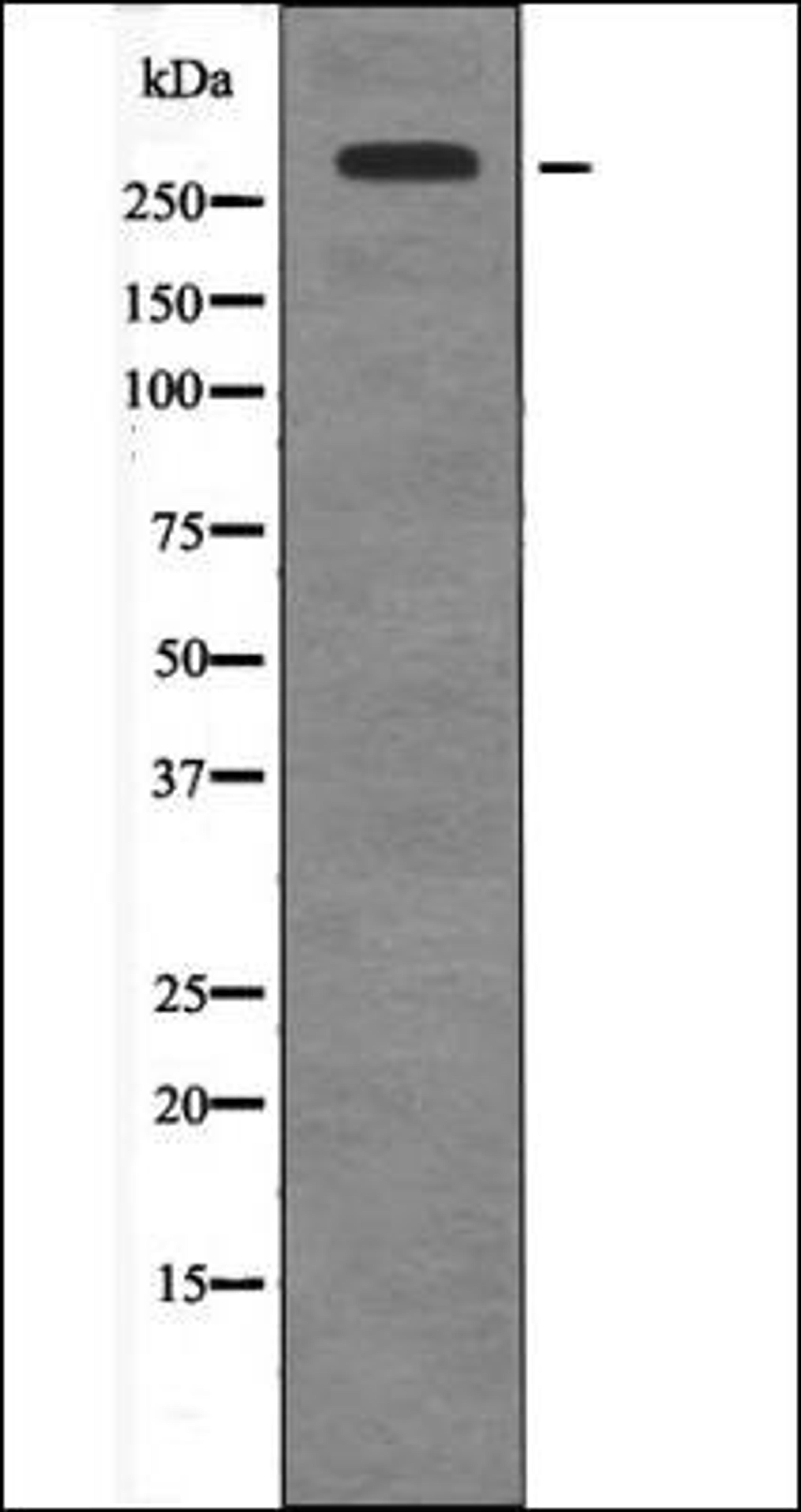 Western blot analysis of EGF treated HepG2 whole cell lysates using Huntingtin -Phospho-Ser421- antibody