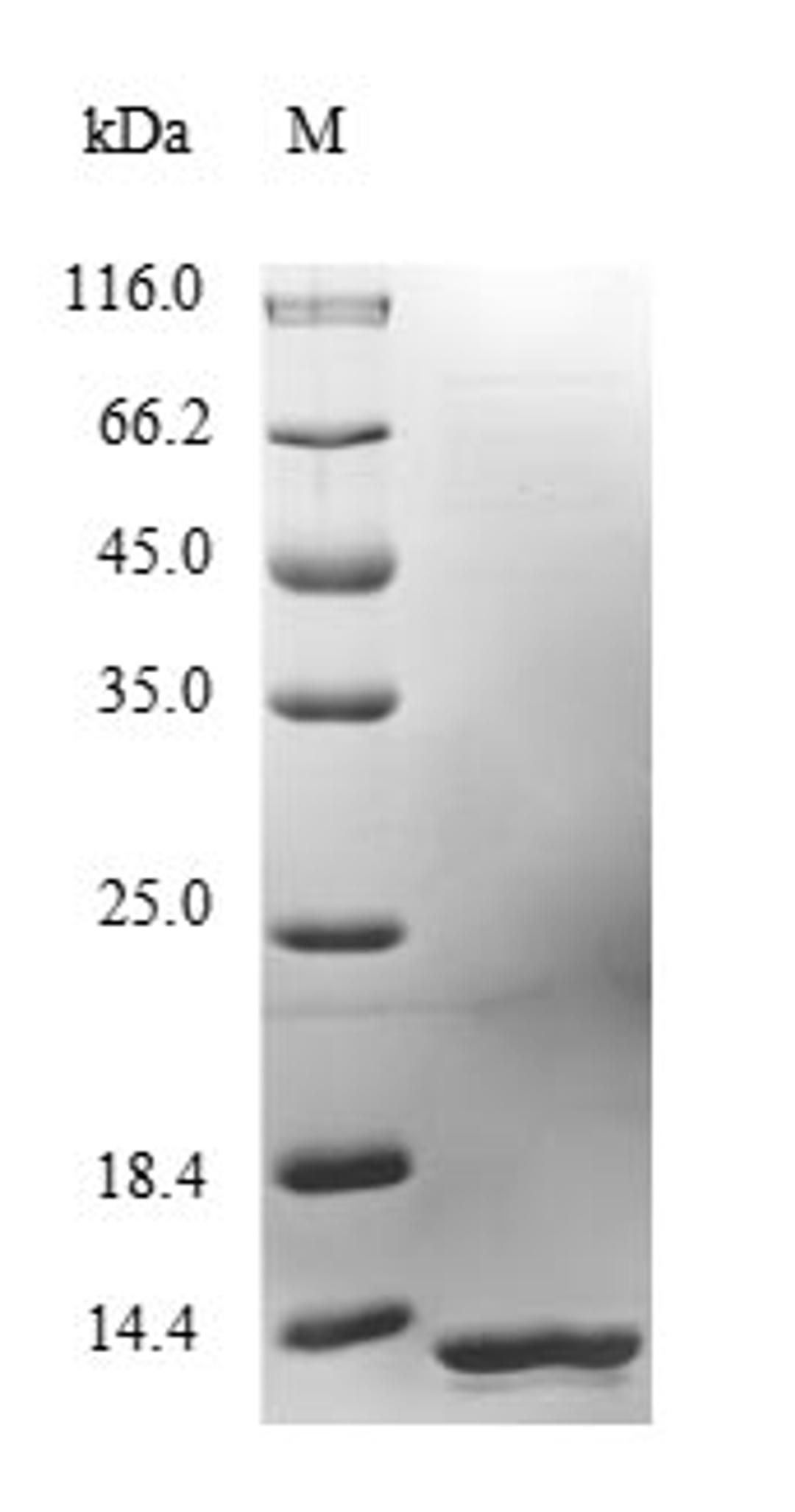(Tris-Glycine gel) Discontinuous SDS-PAGE (reduced) with 5% enrichment gel and 15% separation gel.