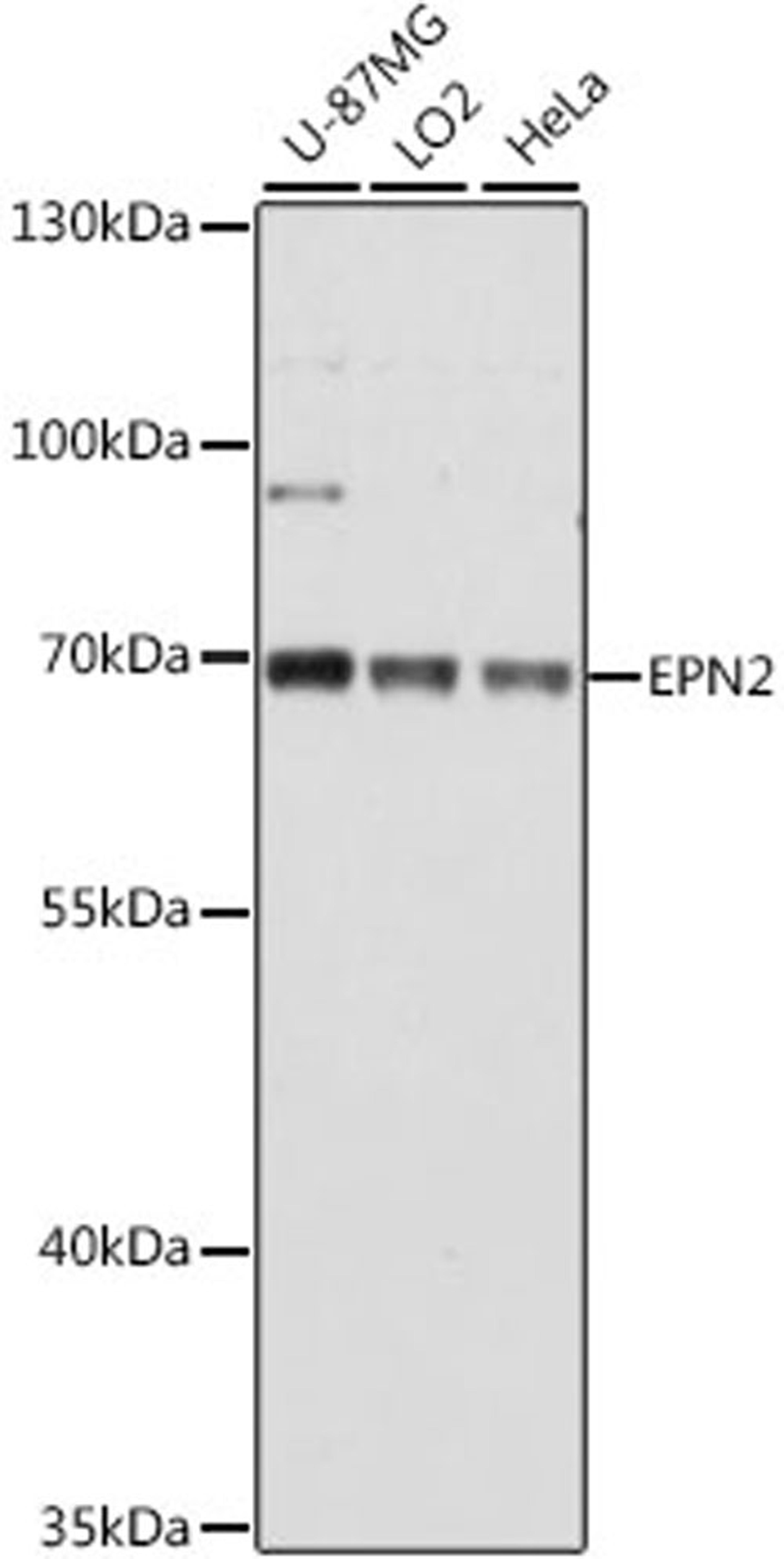 Western blot - EPN2 antibody (A16106)