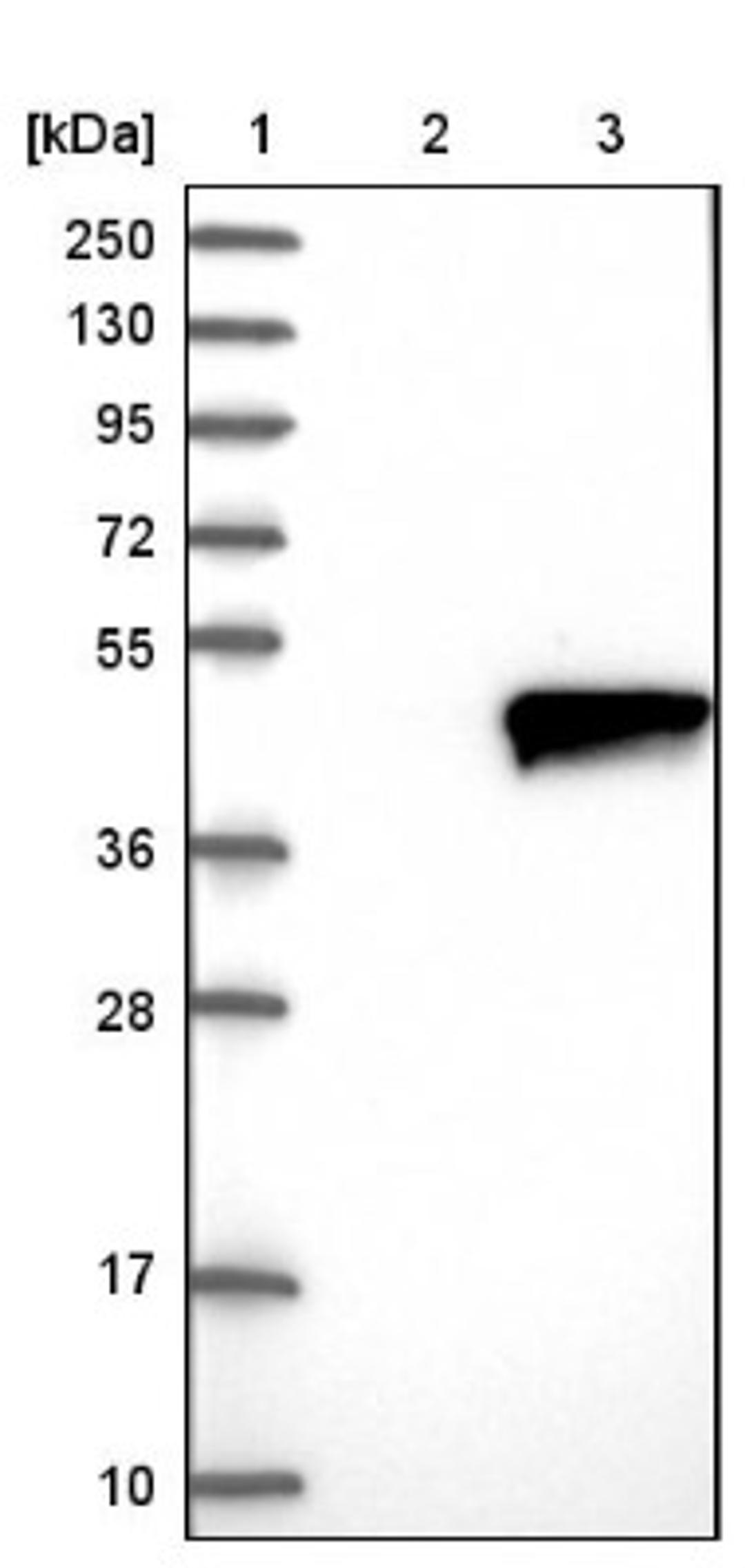 Western Blot: ZADH2 Antibody [NBP1-82679] - Lane 1: Marker [kDa] 250, 130, 95, 72, 55, 36, 28, 17, 10<br/>Lane 2: Negative control (vector only transfected HEK293T lysate)<br/>Lane 3: Over-expression lysate (Co-expressed with a C-terminal myc-DDK tag (~3.1 kDa) in mammalian HEK293T cells, LY406204)