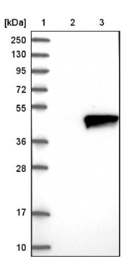 Western Blot: ZADH2 Antibody [NBP1-82679] - Lane 1: Marker [kDa] 250, 130, 95, 72, 55, 36, 28, 17, 10<br/>Lane 2: Negative control (vector only transfected HEK293T lysate)<br/>Lane 3: Over-expression lysate (Co-expressed with a C-terminal myc-DDK tag (~3.1 kDa) in mammalian HEK293T cells, LY406204)