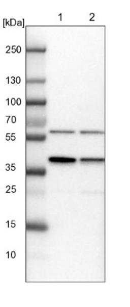 Western Blot: PRP18 Antibody [NBP1-92297] - Lane 1: NIH-3T3 cell lysate (Mouse embryonic fibroblast cells)<br/>Lane 2: NBT-II cell lysate (Rat Wistar bladder tumour cells)