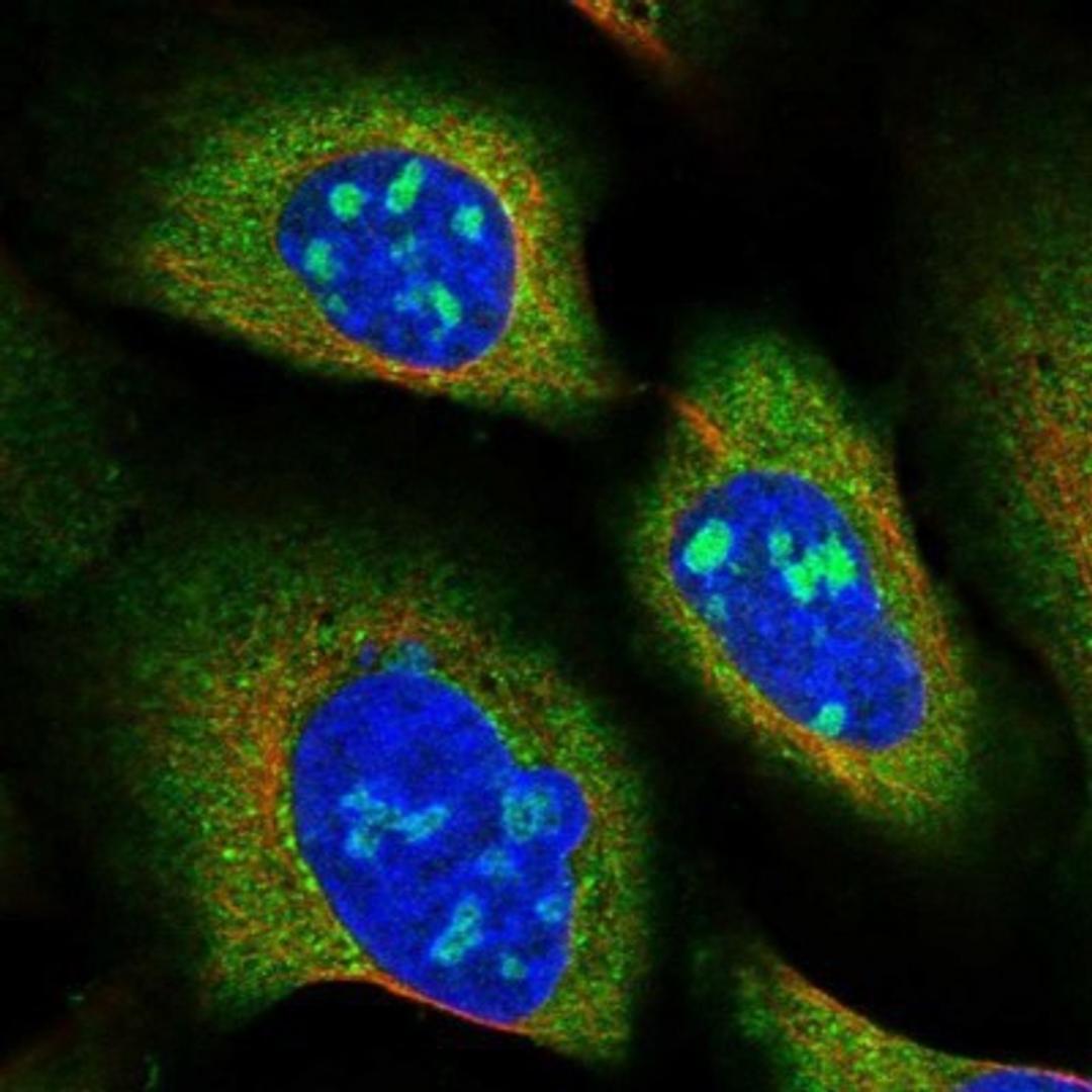 Immunocytochemistry/Immunofluorescence: SNX15 Antibody [NBP1-85866] - Staining of human cell line U-2 OS shows positivity in nucleoli & cytoplasm.