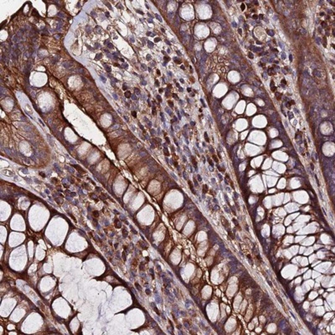 Immunohistochemistry-Paraffin: Exostosin 1 Antibody [NBP1-91875] - Staining of human rectum shows strong membranous and cytoplasmic positivity in glandular cells.