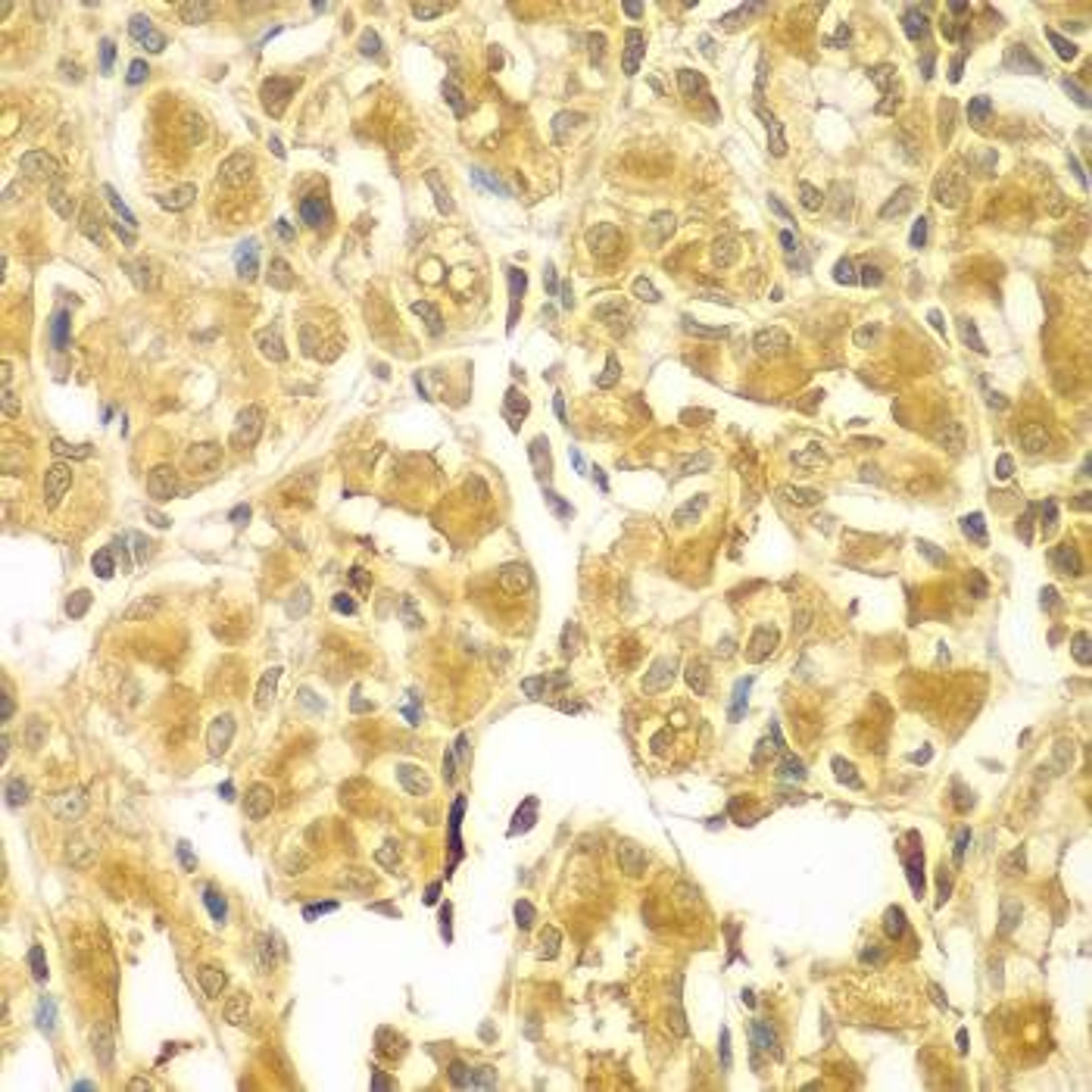 Immunohistochemical staining of human gastric tissue using SESN2 antibody (dilution of 1:100)