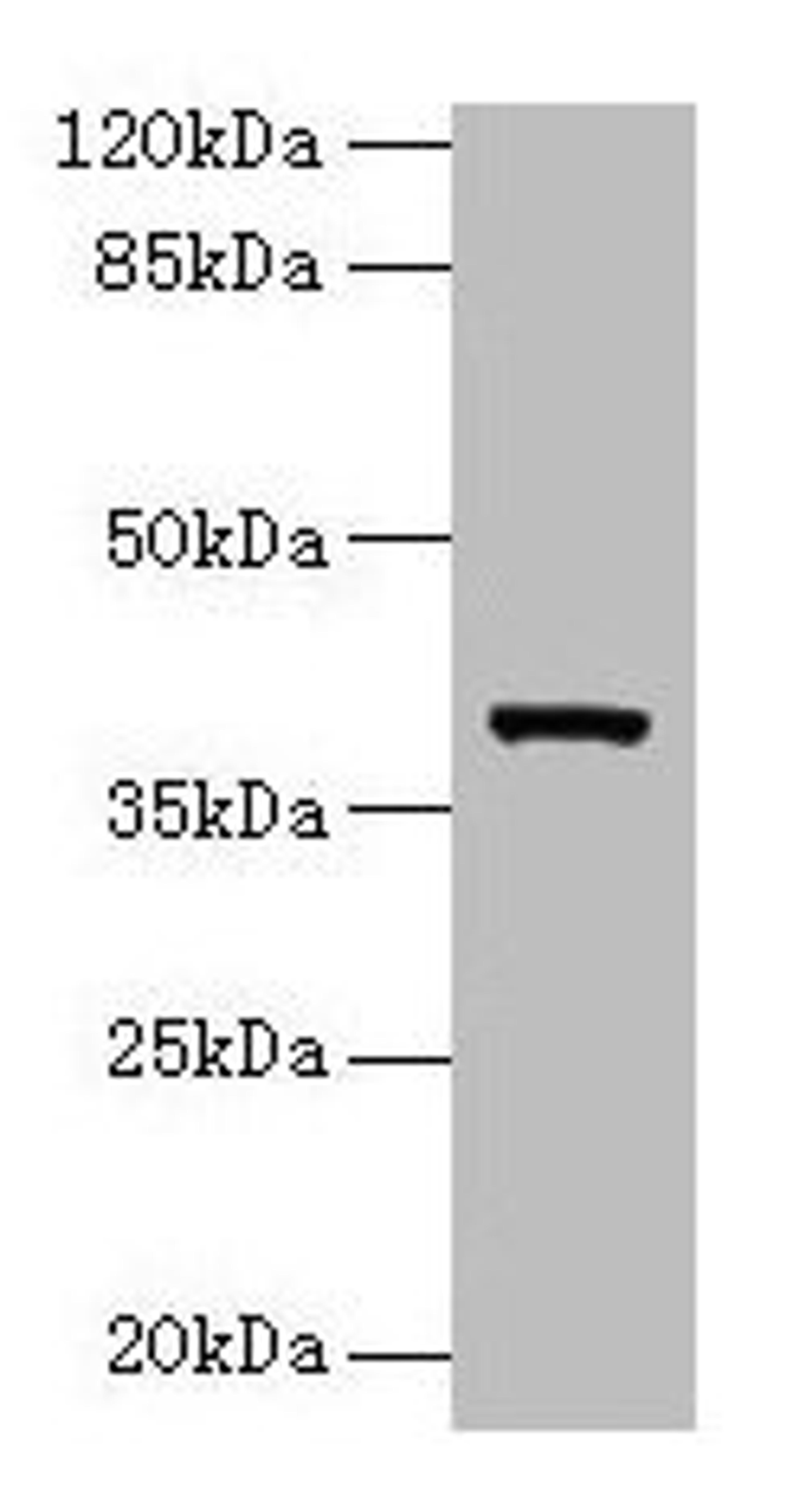 Western blot. All lanes: Arg2 antibody at 10µg/ml + Jurkat whole cell lysate. Secondary. Goat polyclonal to rabbit IgG at 1/10000 dilution. Predicted band size: 39 kDa. Observed band size: 39 kDa