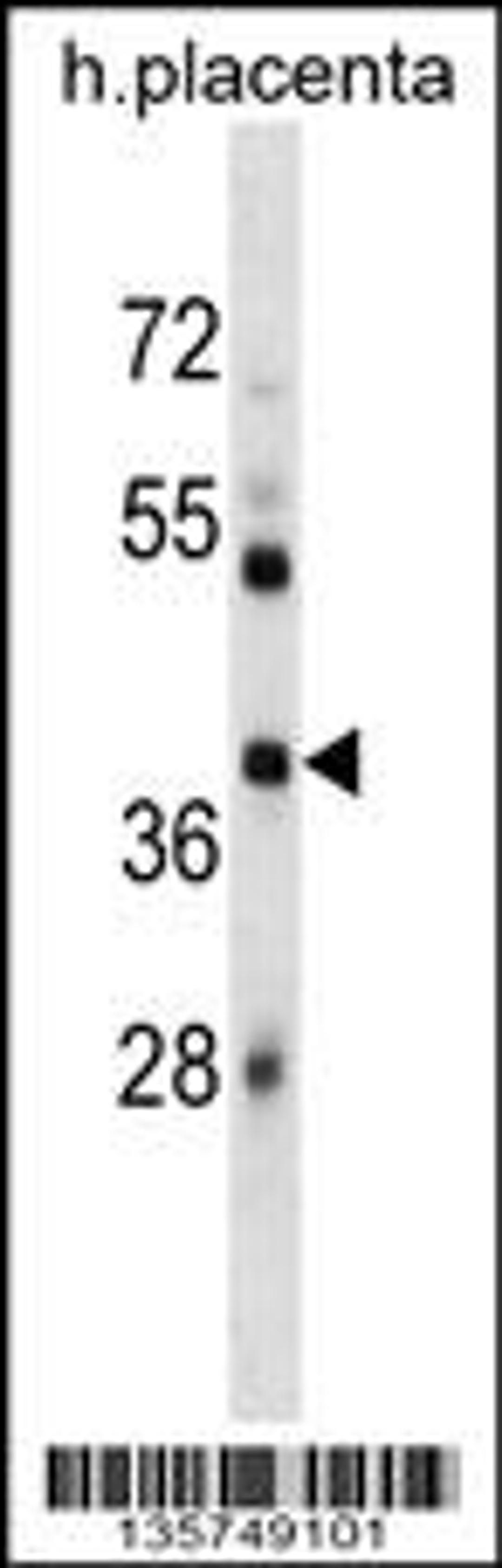 Western blot analysis in human placenta tissue lysates (35ug/lane).