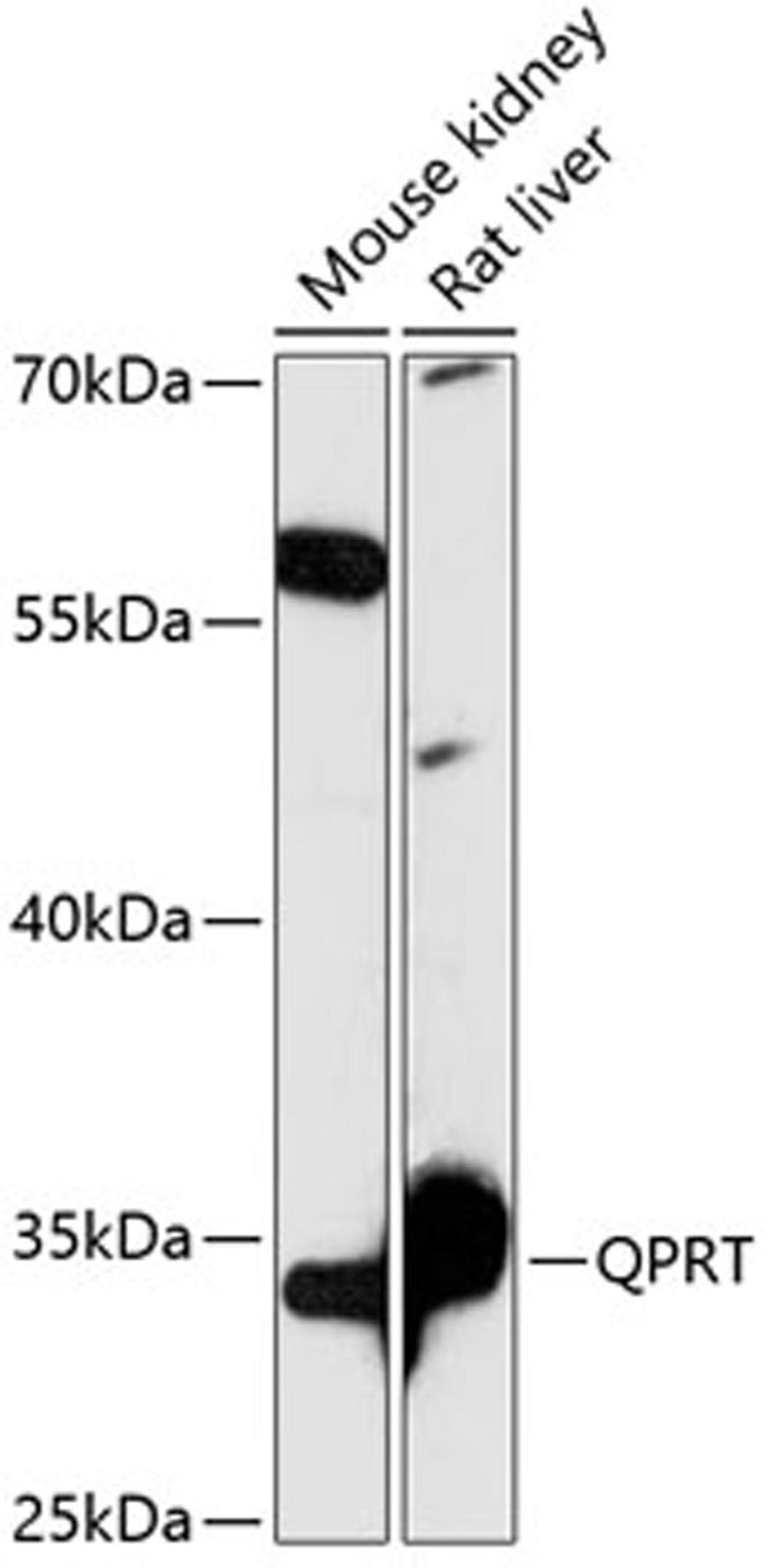 Western blot - QPRT antibody (A14349)