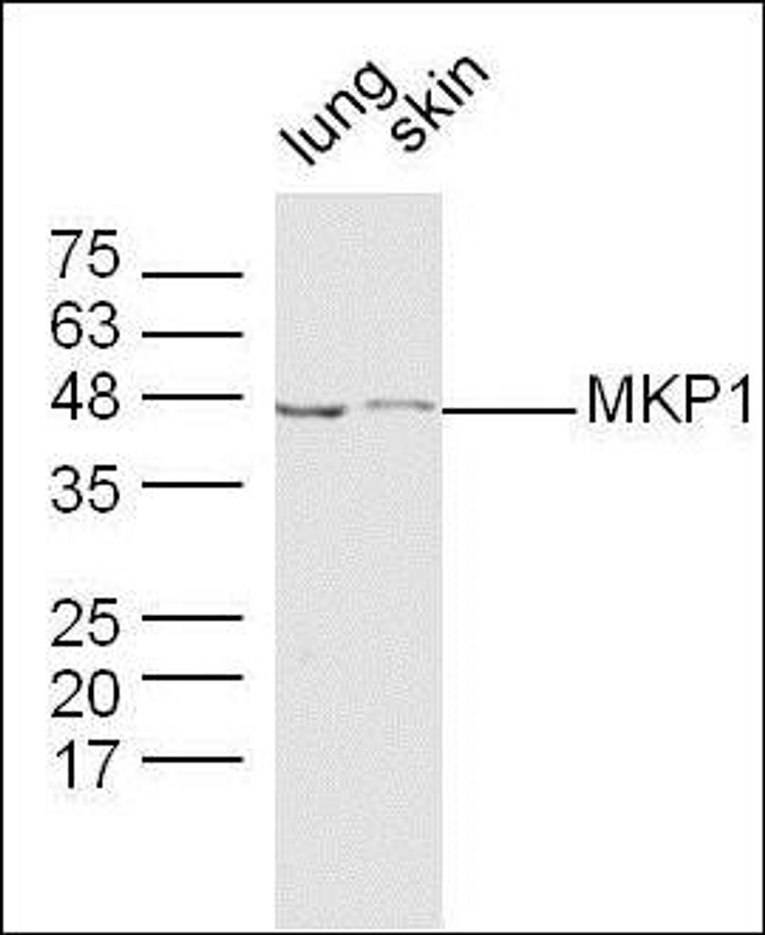 Western blot analysis of mouse Brain lysates (Lane 3) using MKP1 antibody.