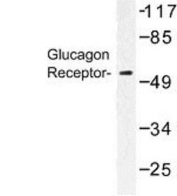 Western Blot: Glucagon R/GCGR Antibody [NBP1-00850] -  Western blot (WB) analysis of Glucagon Receptor (K136) antibody in extracts from COLO205 cells