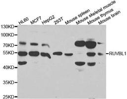 Western blot analysis of extracts of various cell lines using RUVBL1 antibody