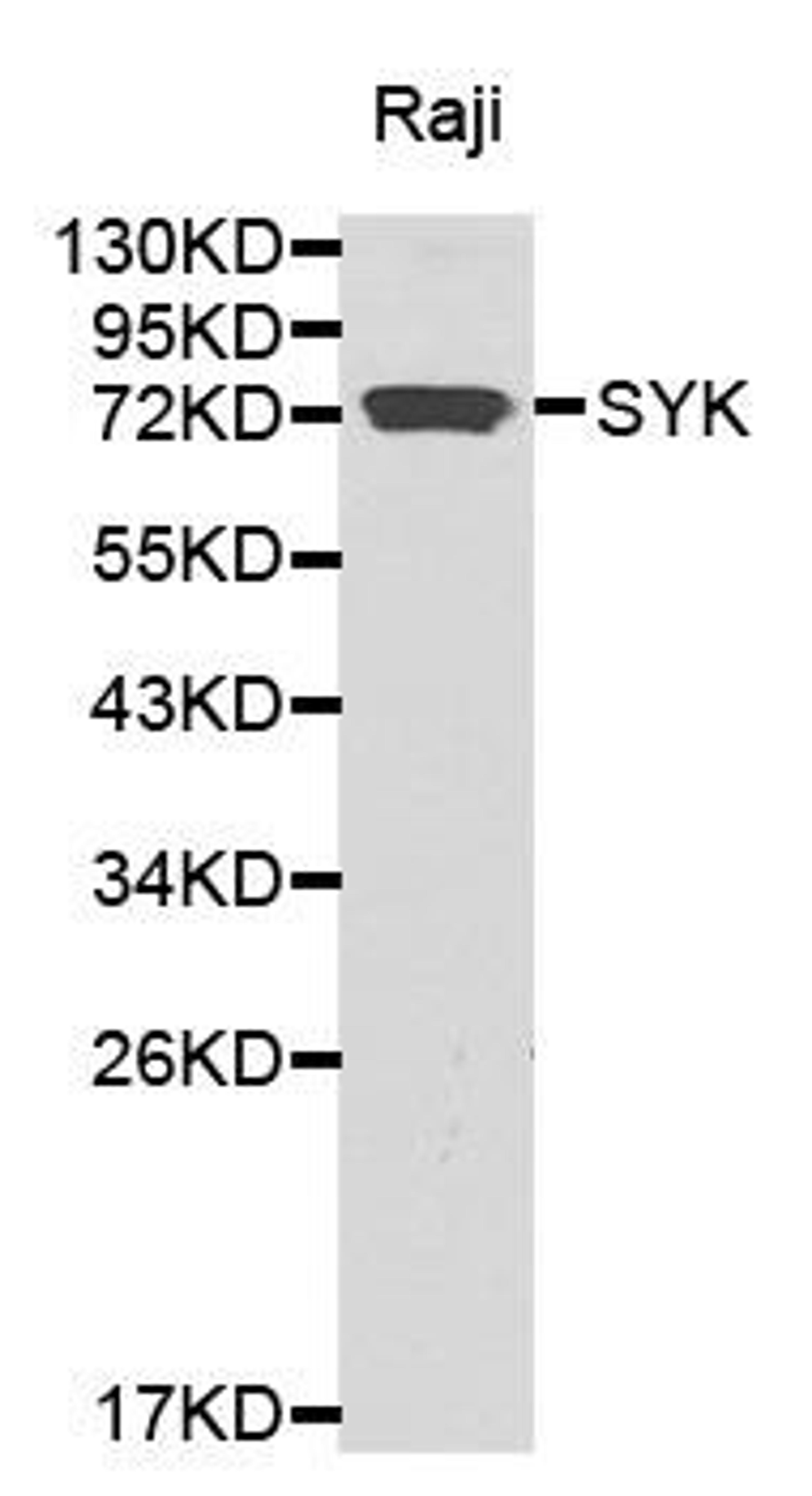 Western blot analysis of extracts of Raji cell lines using SYK antibody