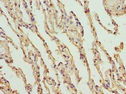 Immunohistochemistry of paraffin-embedded human lung tissue using CSB-PA06329A0Rb at dilution of 1:100
