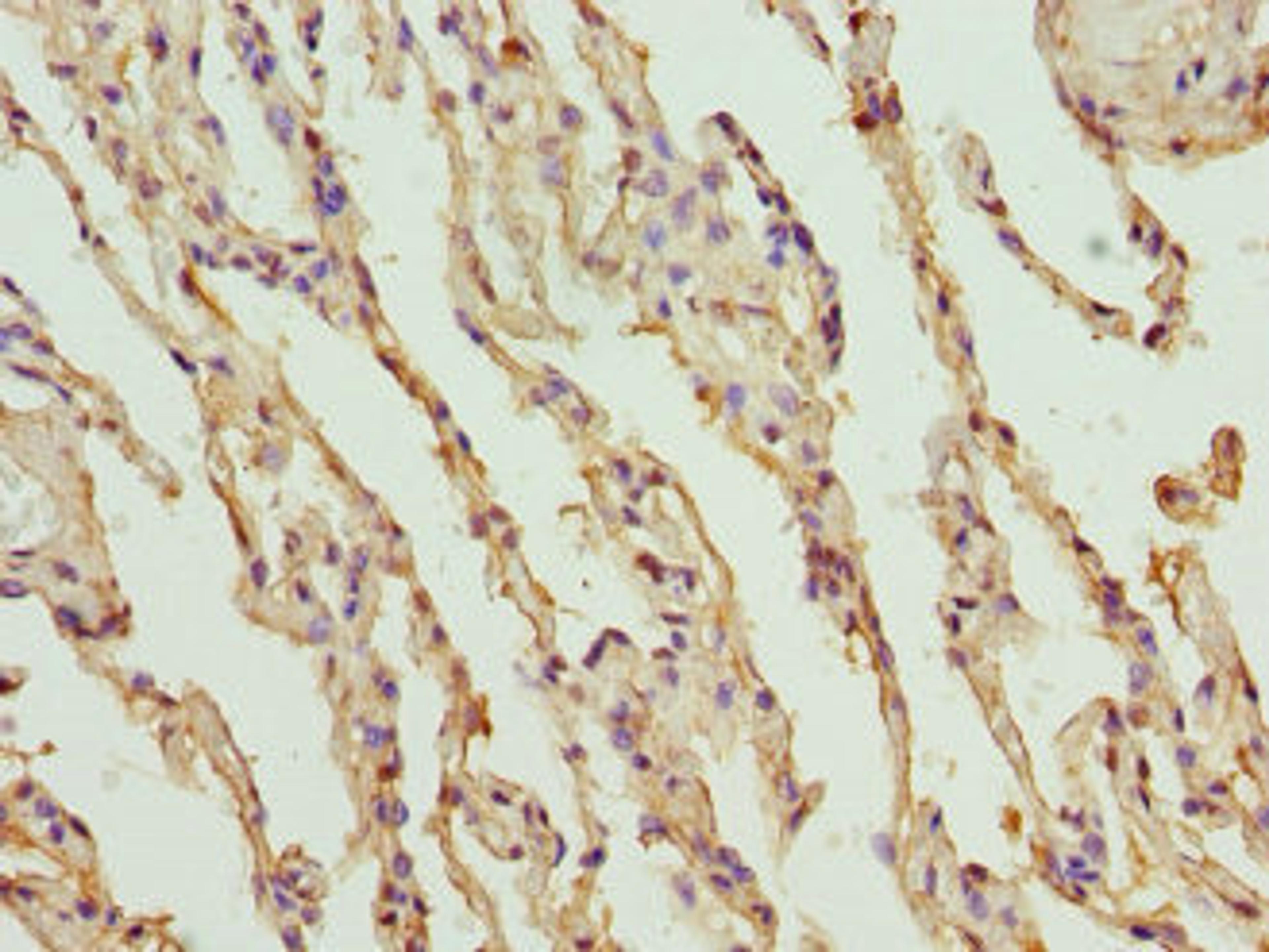 Immunohistochemistry of paraffin-embedded human lung tissue using CSB-PA06329A0Rb at dilution of 1:100