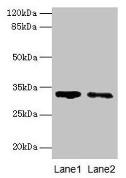 Western blot. All lanes: SLA antibody at 5µg/ml. Lane 1: 293T whole cell lysate. Lane 2: A431 whole cell lysate. Secondary. Goat polyclonal to rabbit IgG at 1/10000 dilution. Predicted band size: 32, 20, 34, 28, 36 kDa. Observed band size: 32 kDa