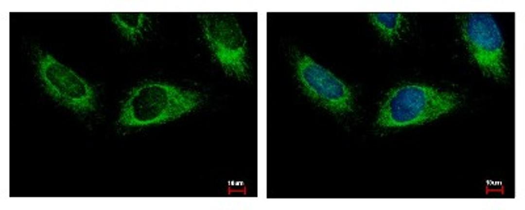 Immunocytochemistry/Immunofluorescence: HPS3 Antibody [NBP1-31061] - Sample: HeLa cells were fixed in 4% paraformaldehyde at RT for 15 min. Green: HPS3 protein stained by HPS3 antibody, C-term diluted at 1:500. Blue: Hoechst 33343 staining.