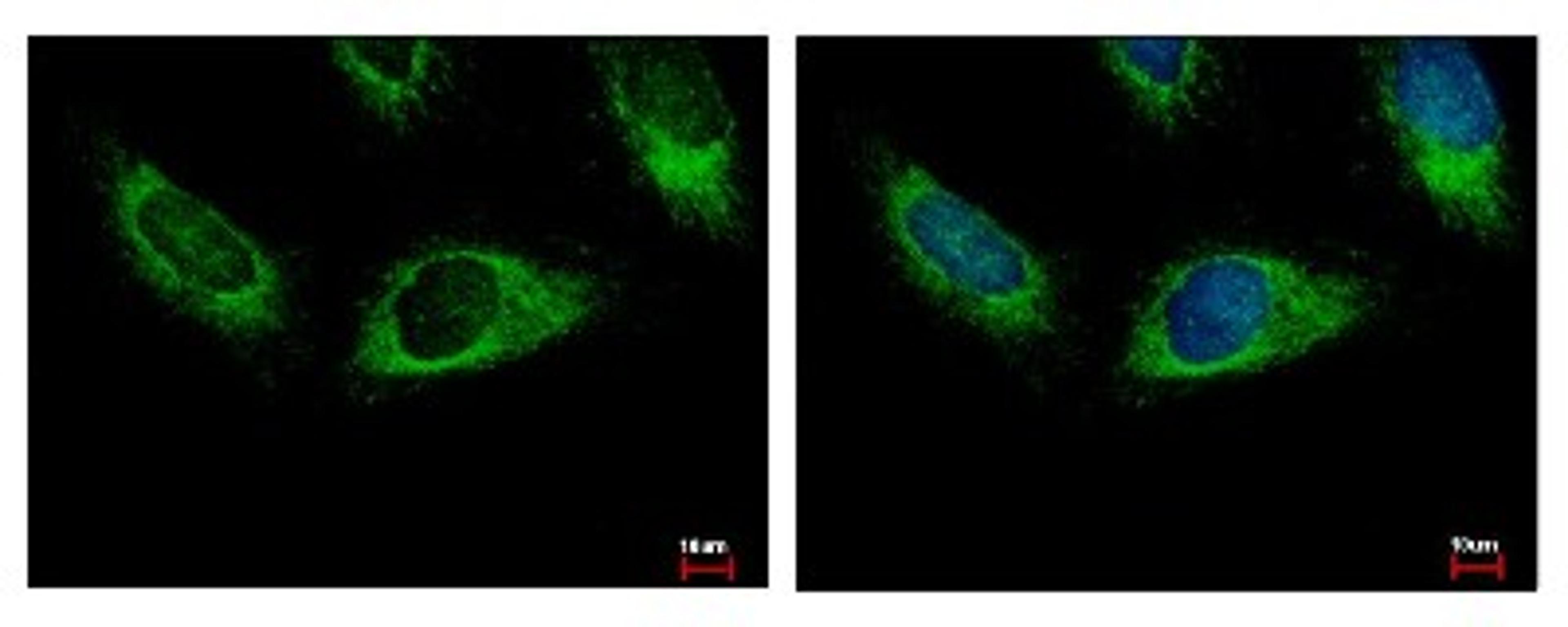 Immunocytochemistry/Immunofluorescence: HPS3 Antibody [NBP1-31061] - Sample: HeLa cells were fixed in 4% paraformaldehyde at RT for 15 min. Green: HPS3 protein stained by HPS3 antibody, C-term diluted at 1:500. Blue: Hoechst 33343 staining.