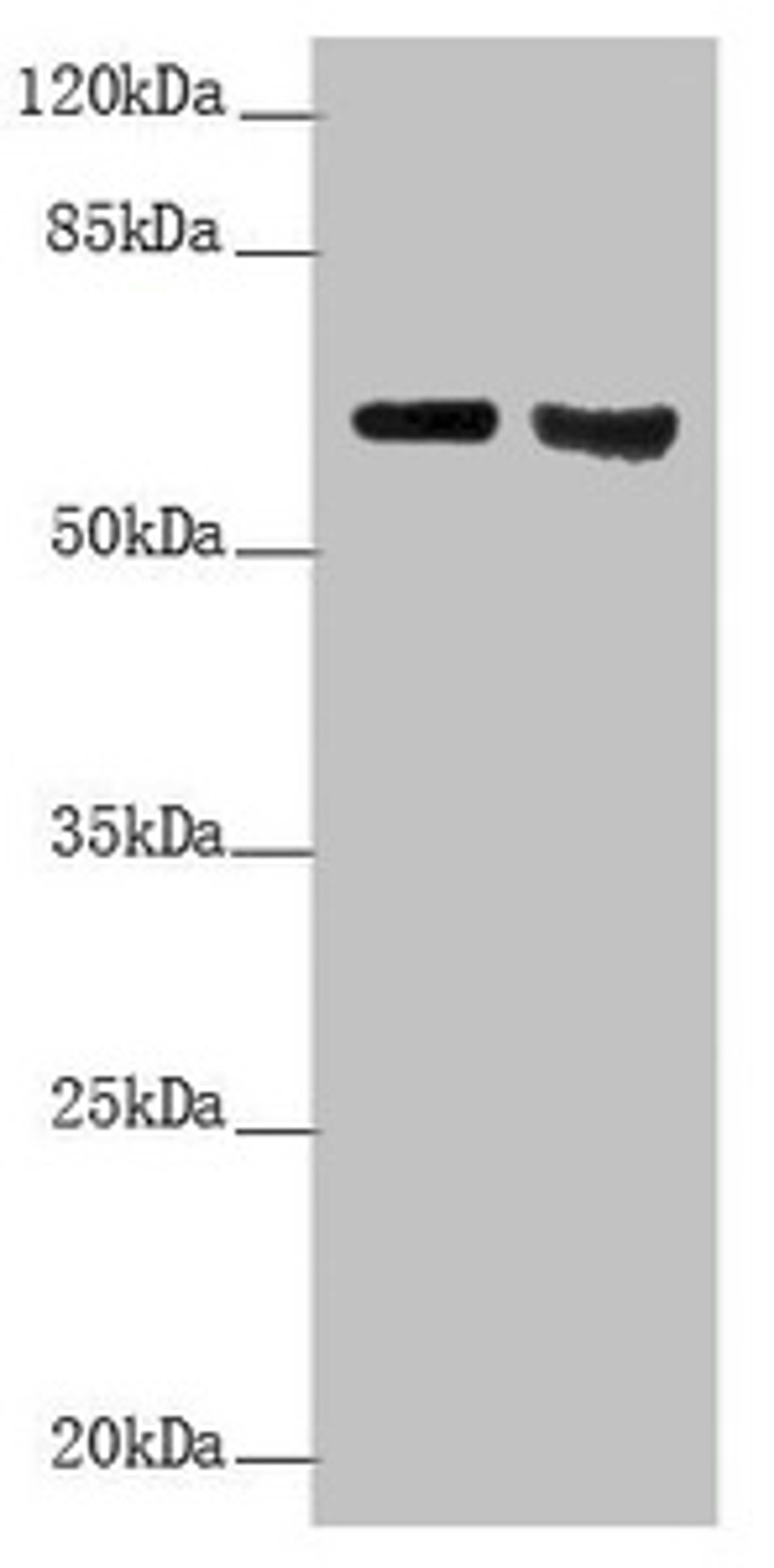 Western blot. All lanes: KRT6A antibody at 5.82 ug/ml. Lane 1: Mouse lung tissue. Lane 2: A431 whole cell lysate. Secondary. Goat polyclonal to rabbit IgG at 1/10000 dilution. Predicted band size: 60 kDa. Observed band size: 60 kDa. 
